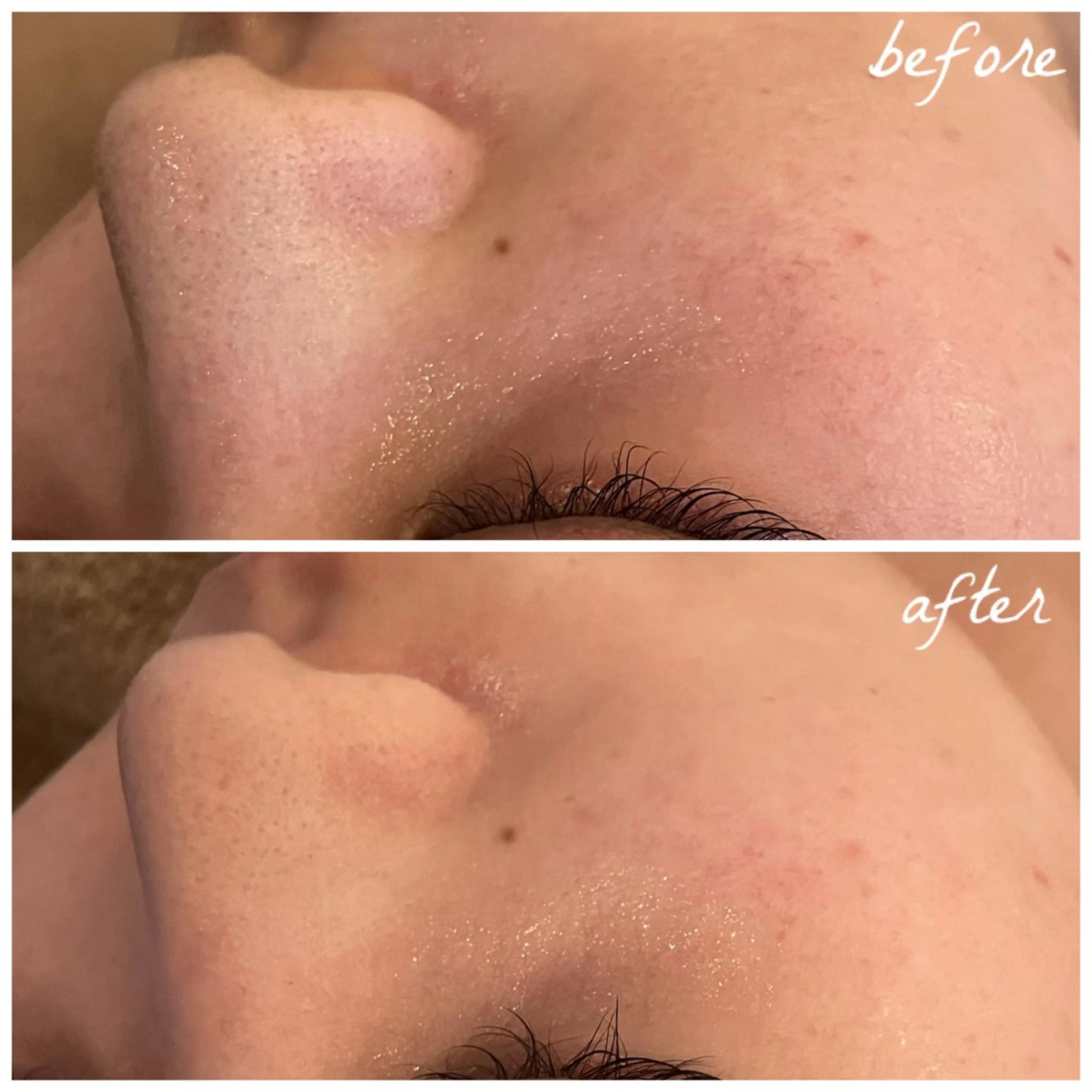 メンズ エステ メナード岐阜茜部 杉浦のエステ・リラクイメージ