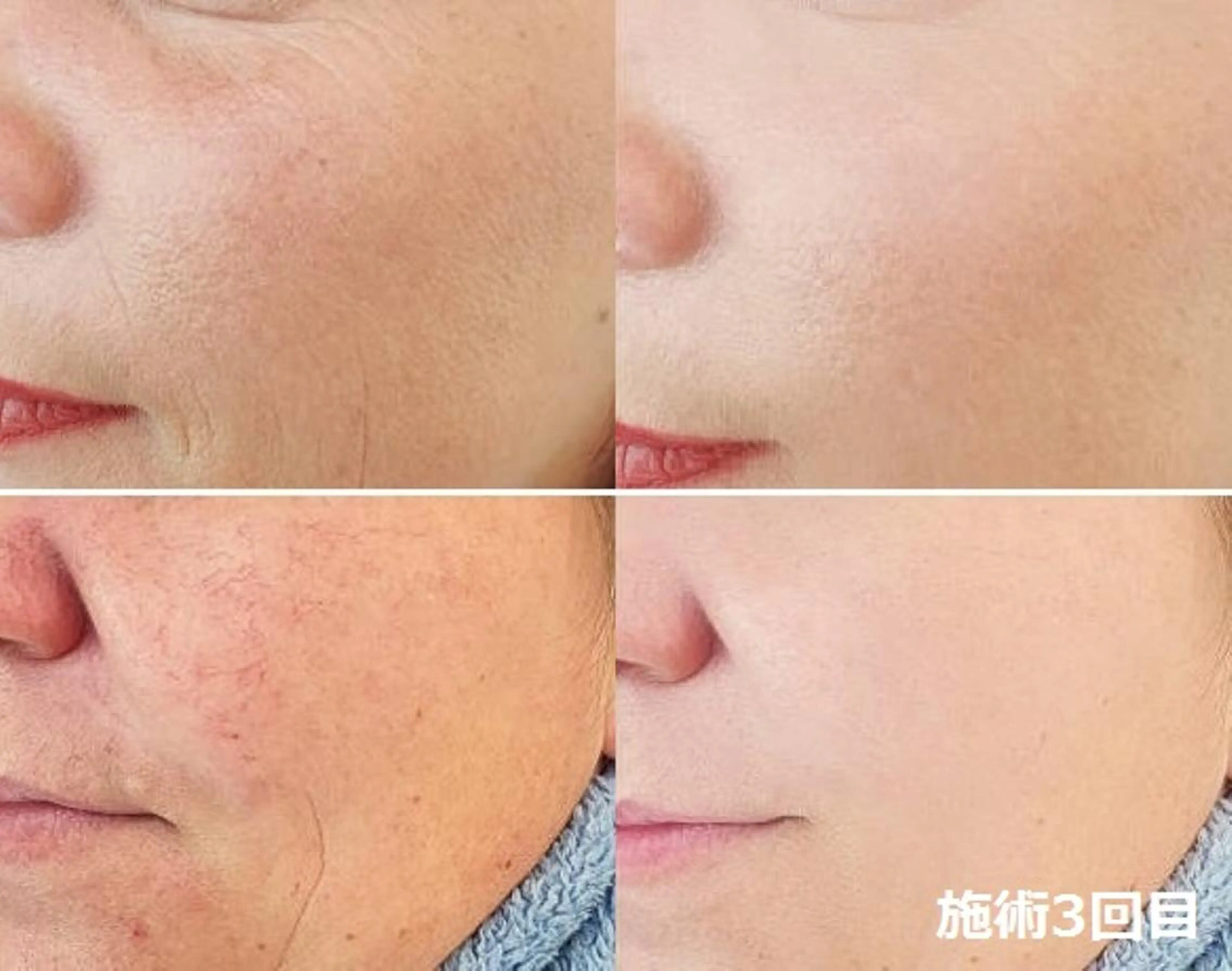 全身脱毛＆VIO脱毛 紹介率№1♪リナ♪のエステ・リラクイメージ