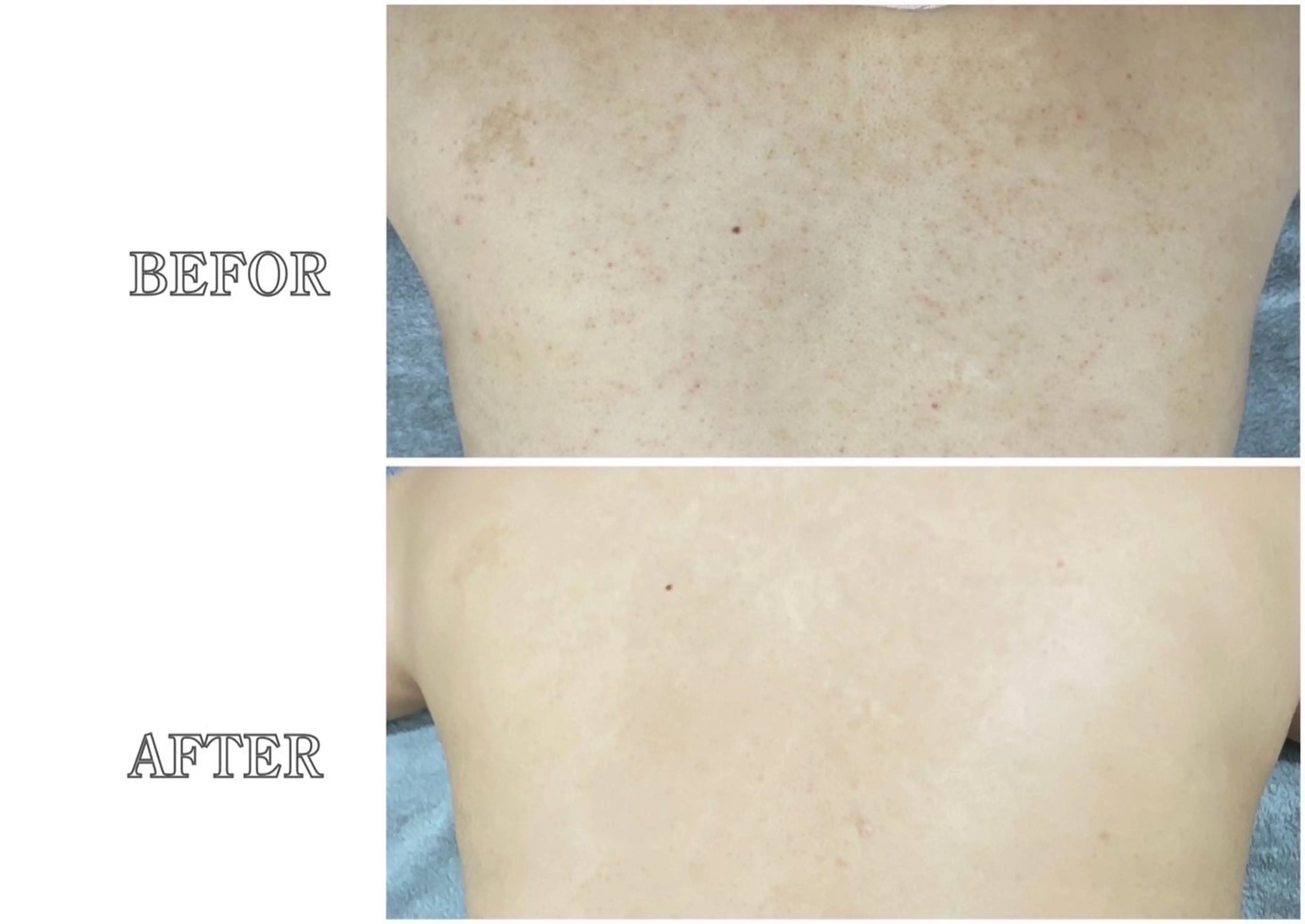 Lys Blancのエステ・リラクイメージ