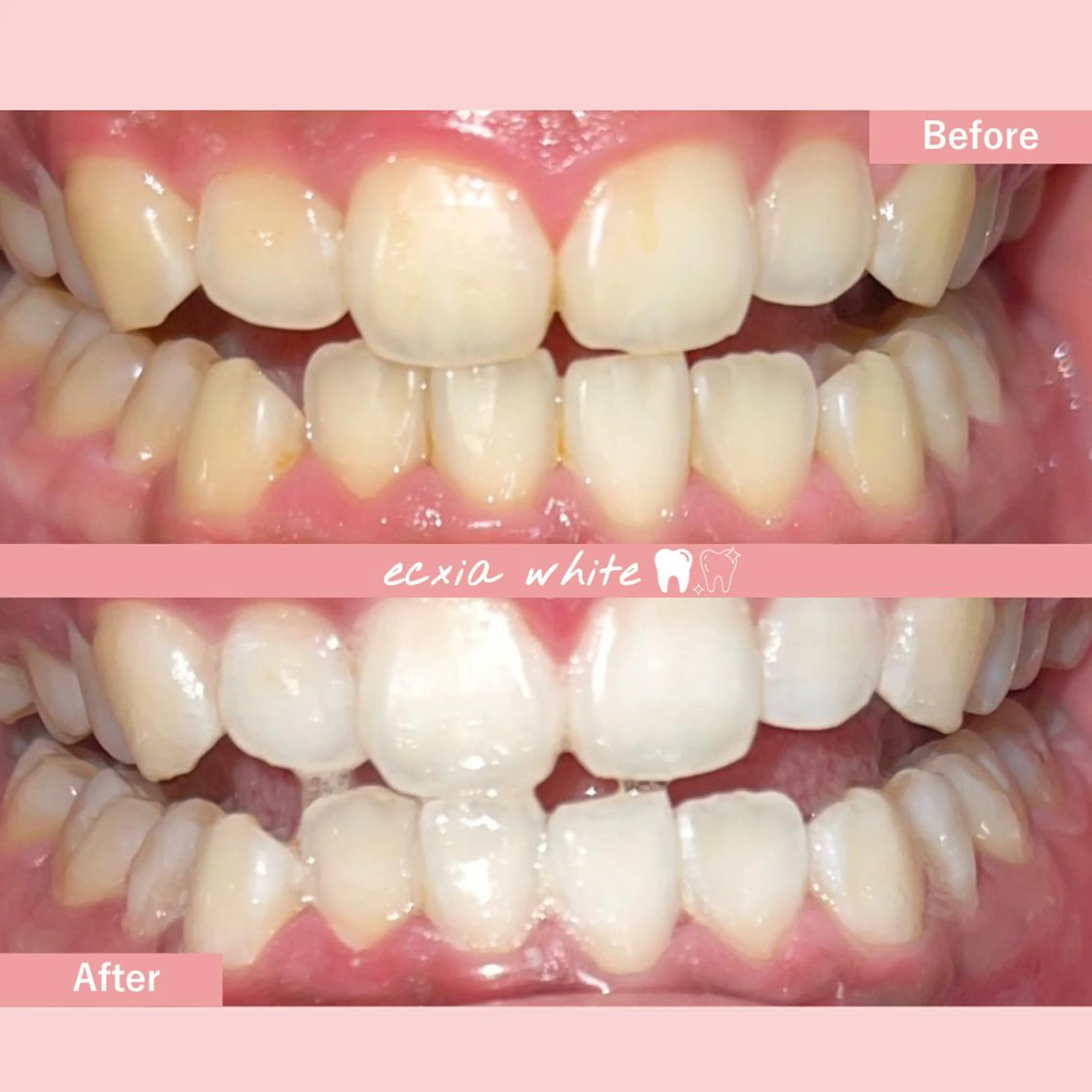 セルフホワイトニング エクシア中島公園店のその他イメージ