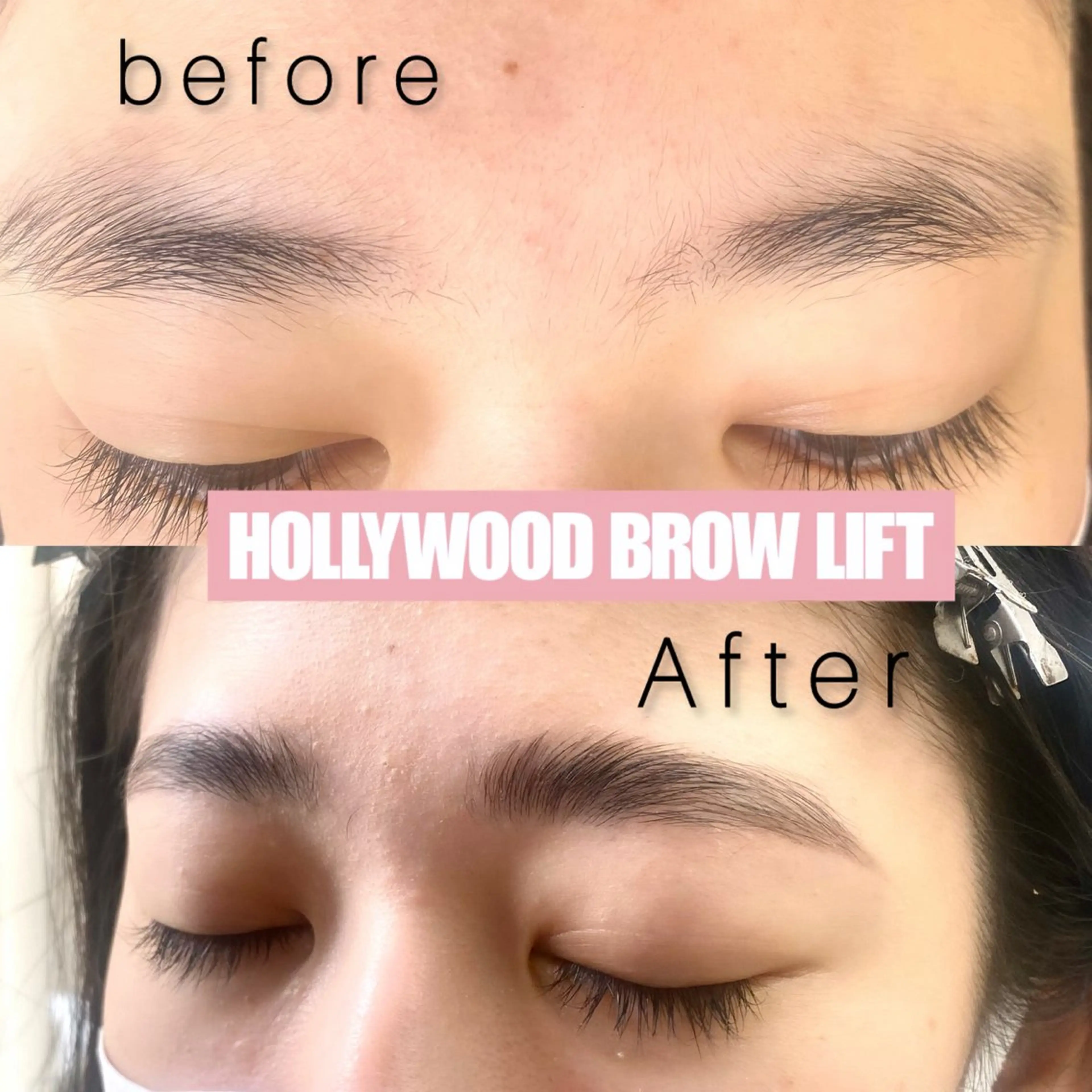 【HBL】ハリウッドブロウリフト＋Wax脱毛の写真