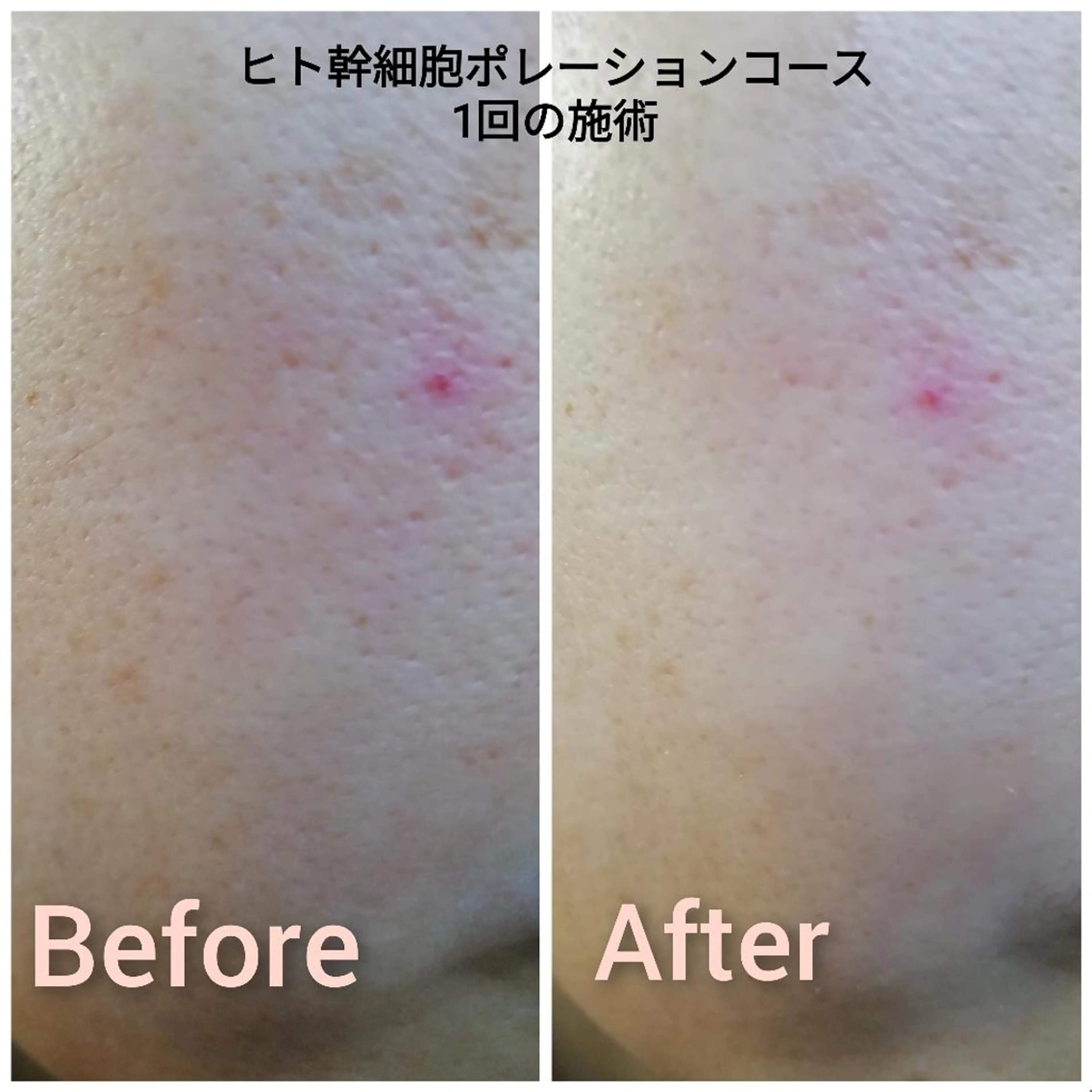 エステ エステサロン　Lazulisea所属・川口 春奈のエステ・リラクイメージ