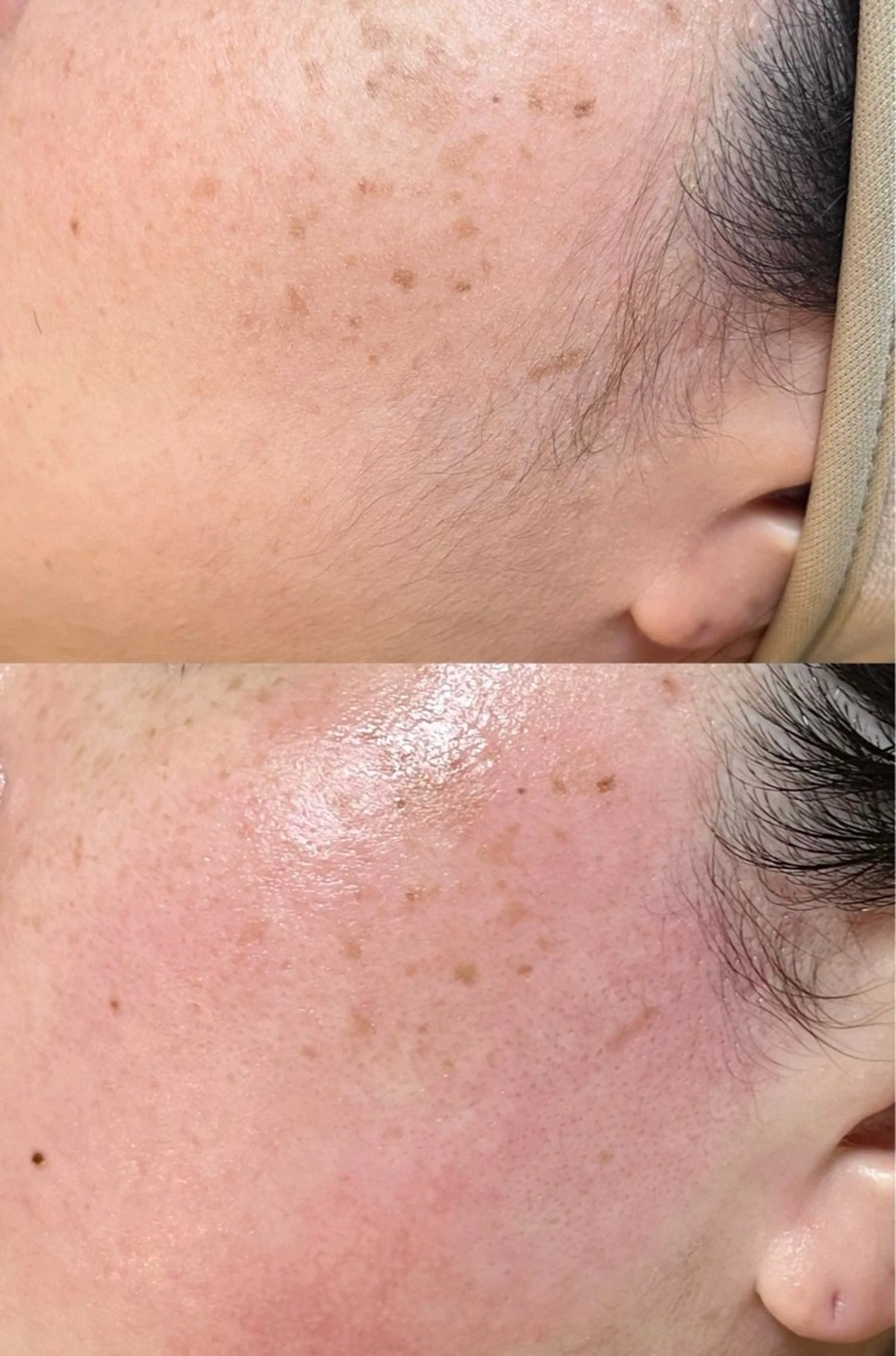 脱毛 Lululia ルルリアのエステ・リラクイメージ