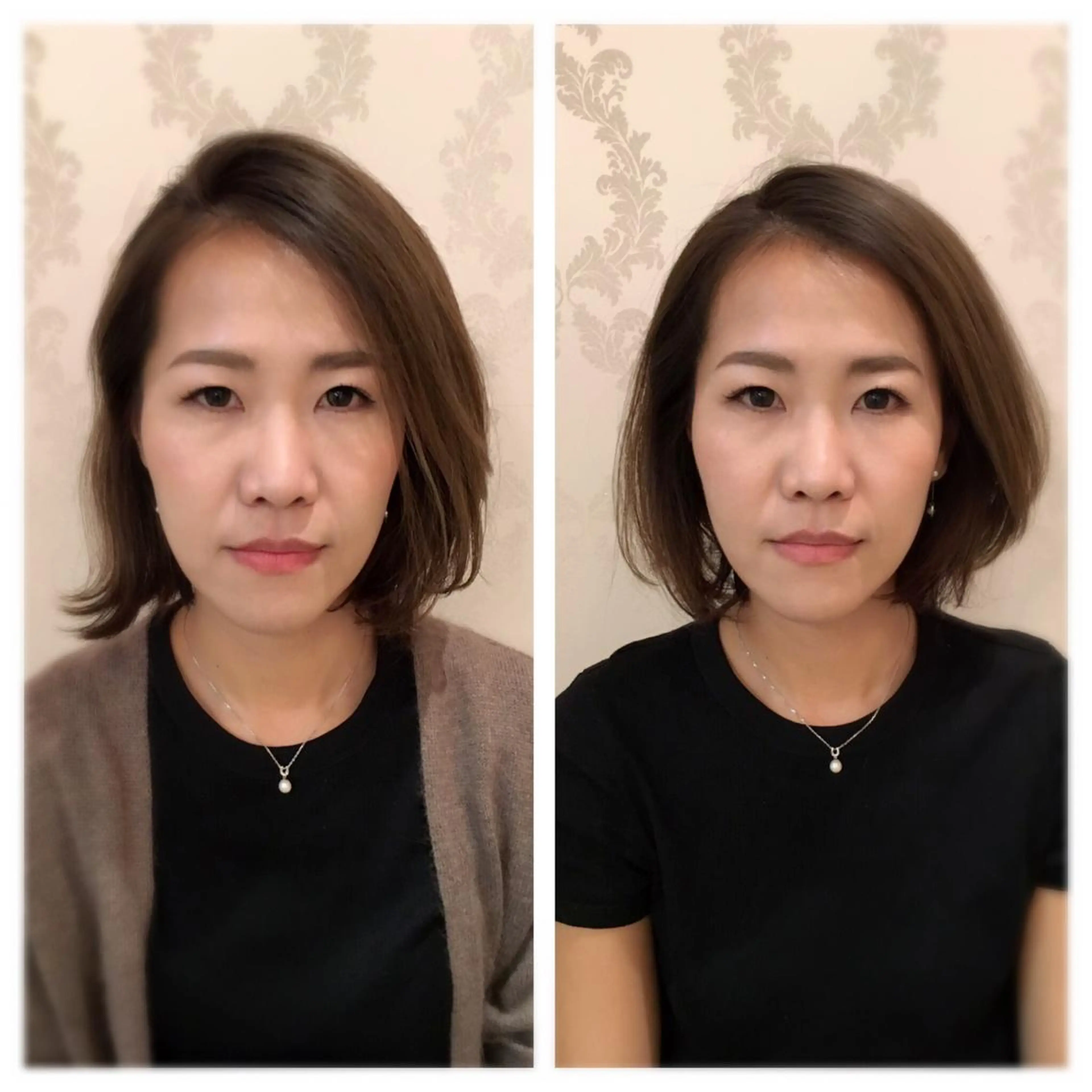 美容鍼サロン    Fleurir所属・伊藤 かなえのエステ・リラクイメージ