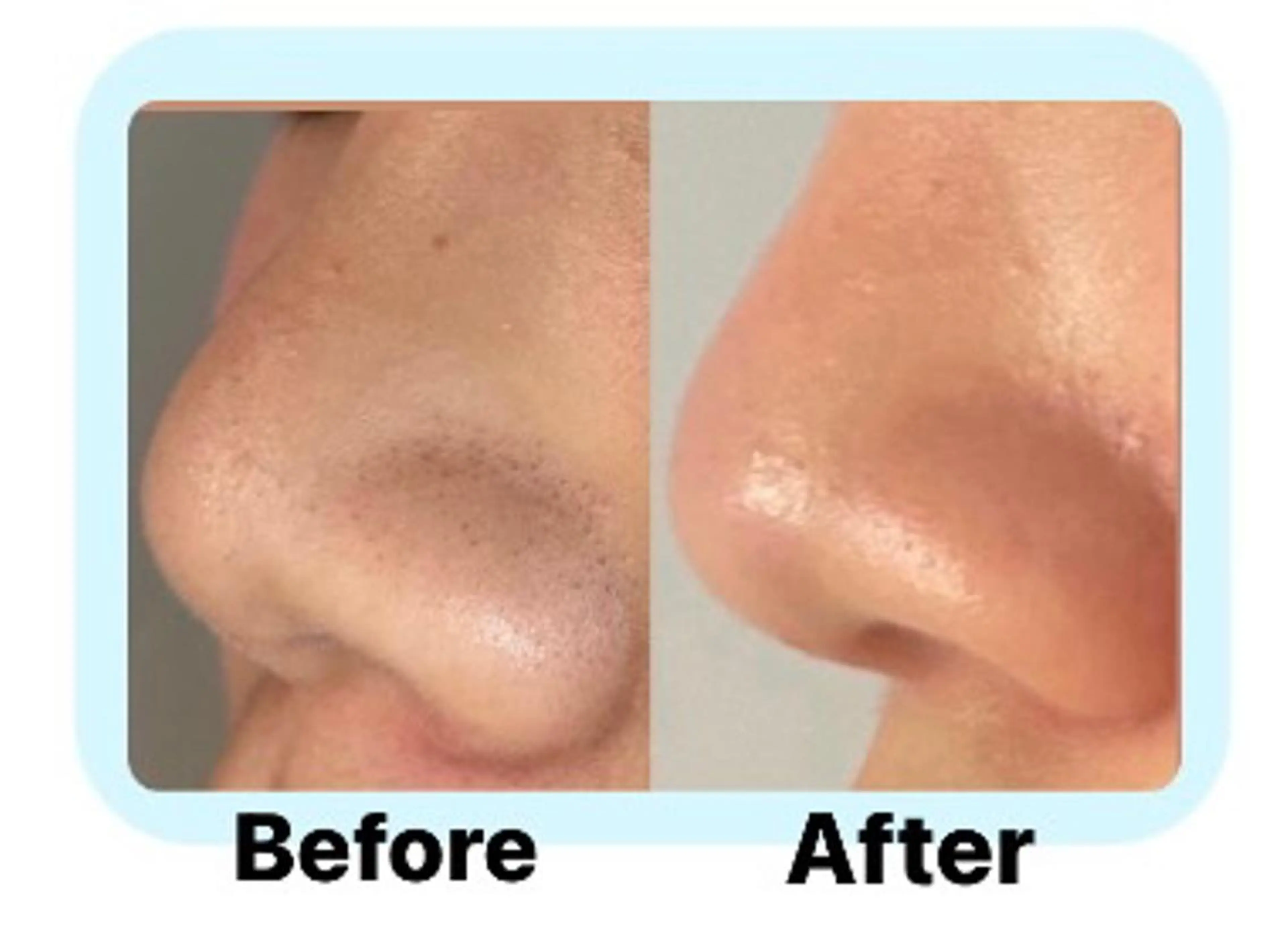 moi-meme 　のその他イメージ