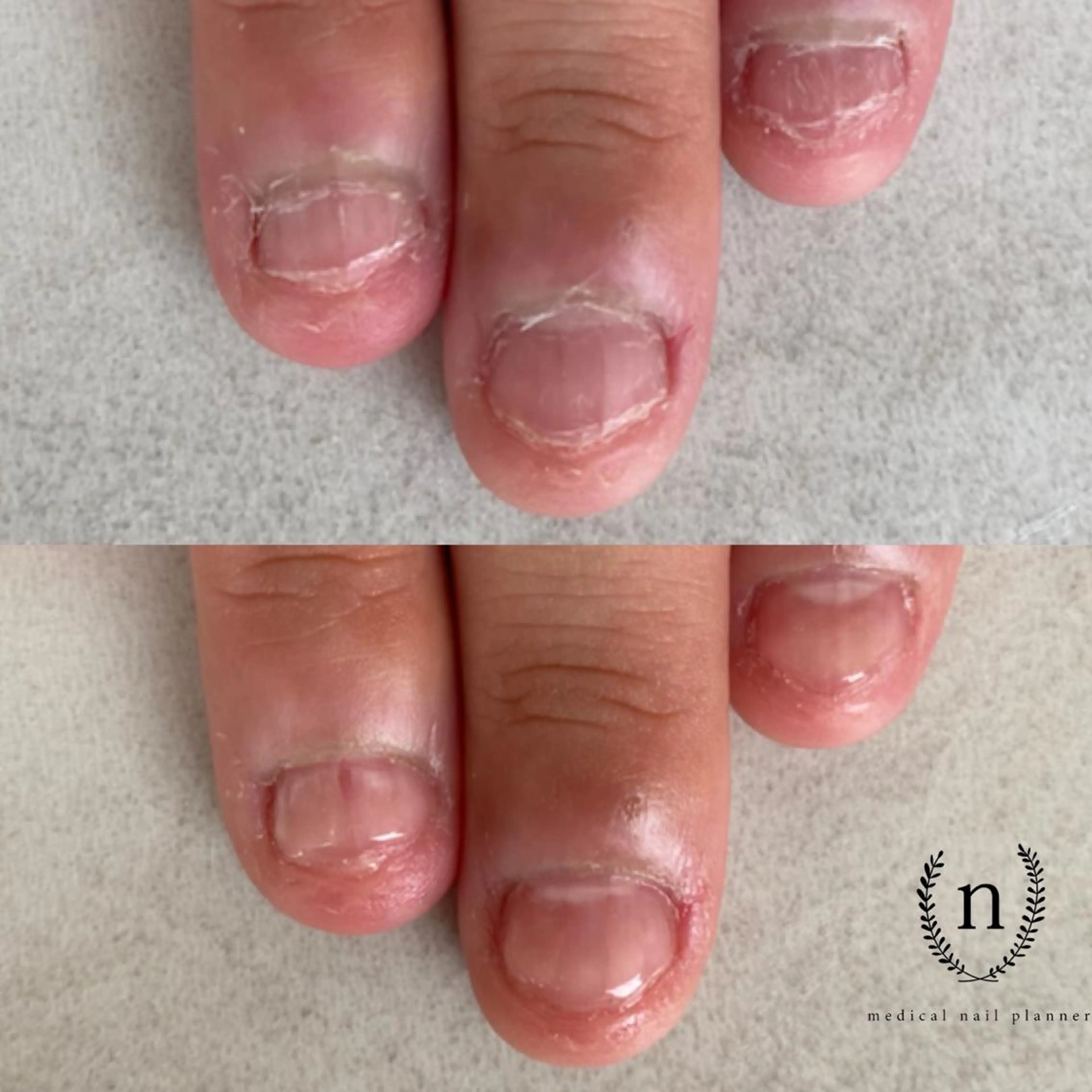 ネイル Rio 𓍼のネイルデザイン