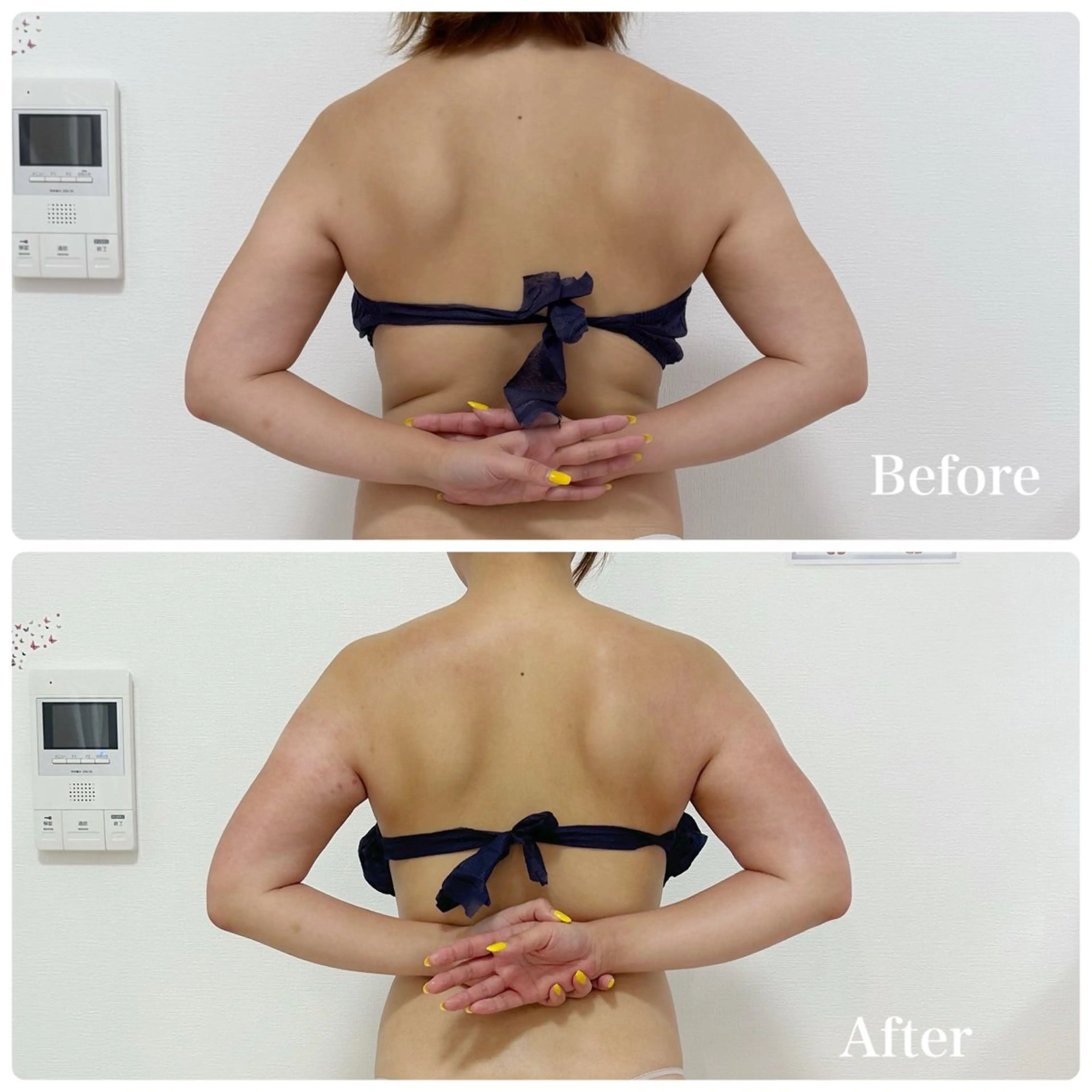 エステ Liam《美肌管理/ 3D小顔/脂肪ケア》のエステ・リラクイメージ