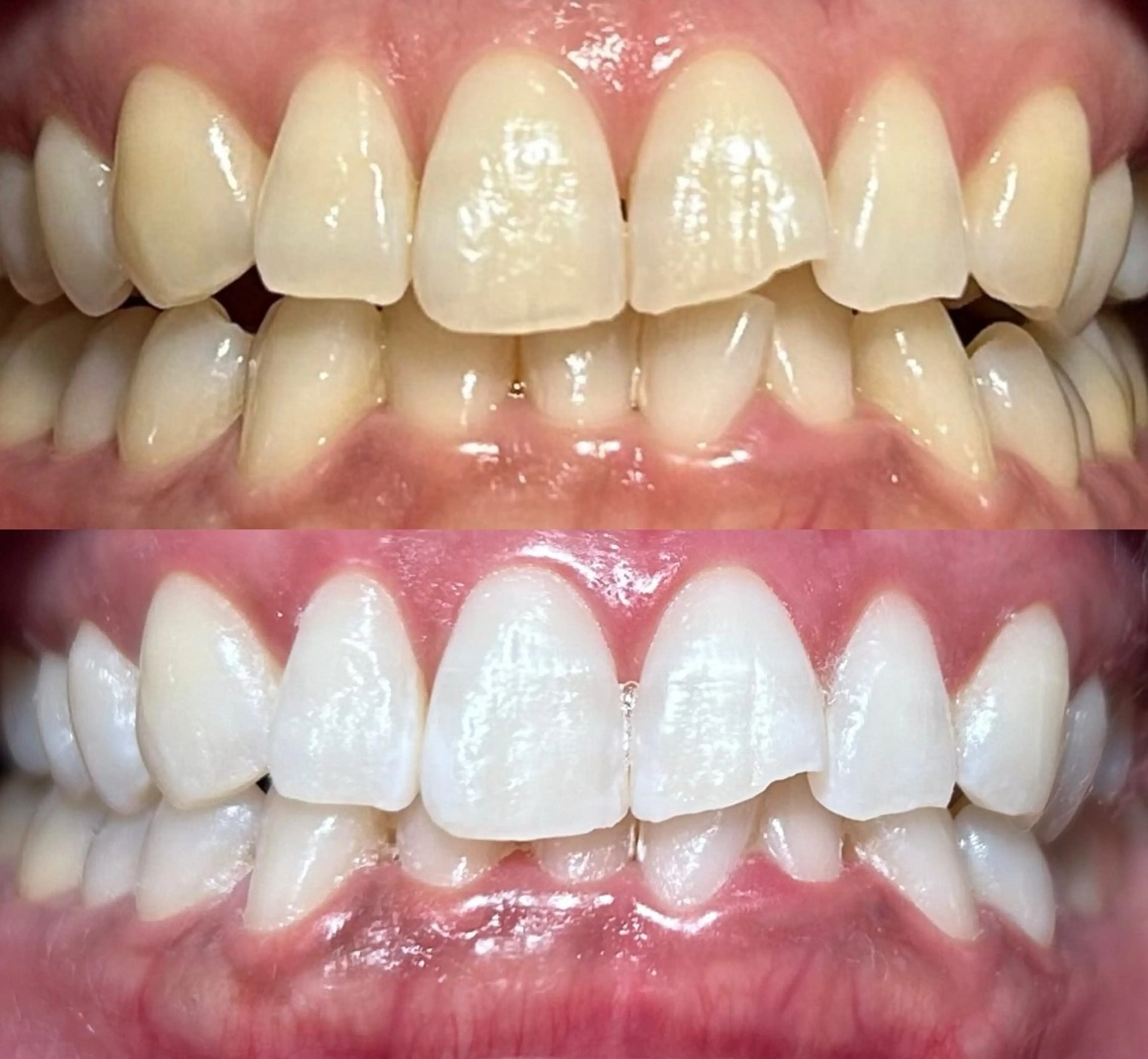 io teeth careのその他イメージ