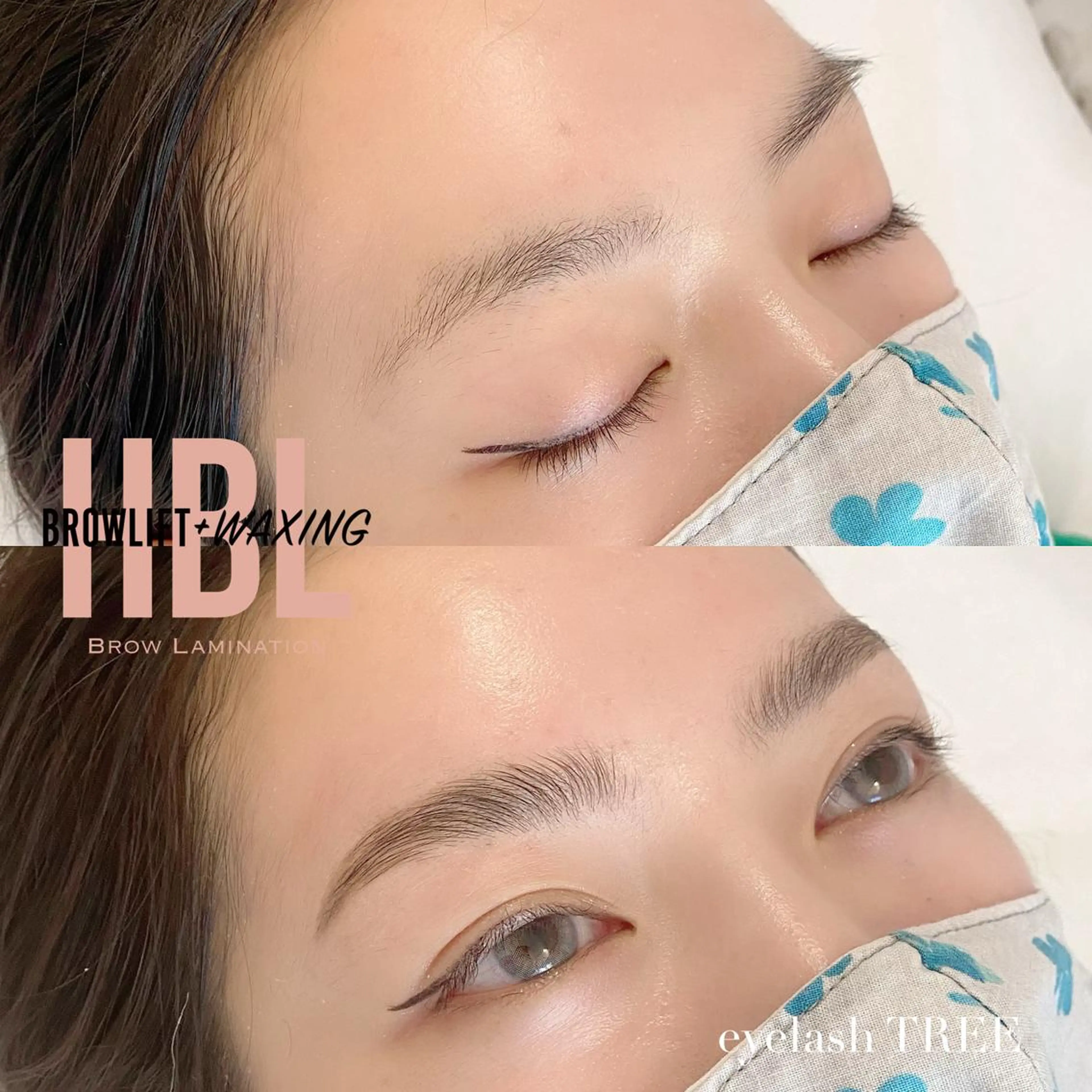 マツエク・マツパ まつげ、毛穴 TREEのエステ・リラクイメージ