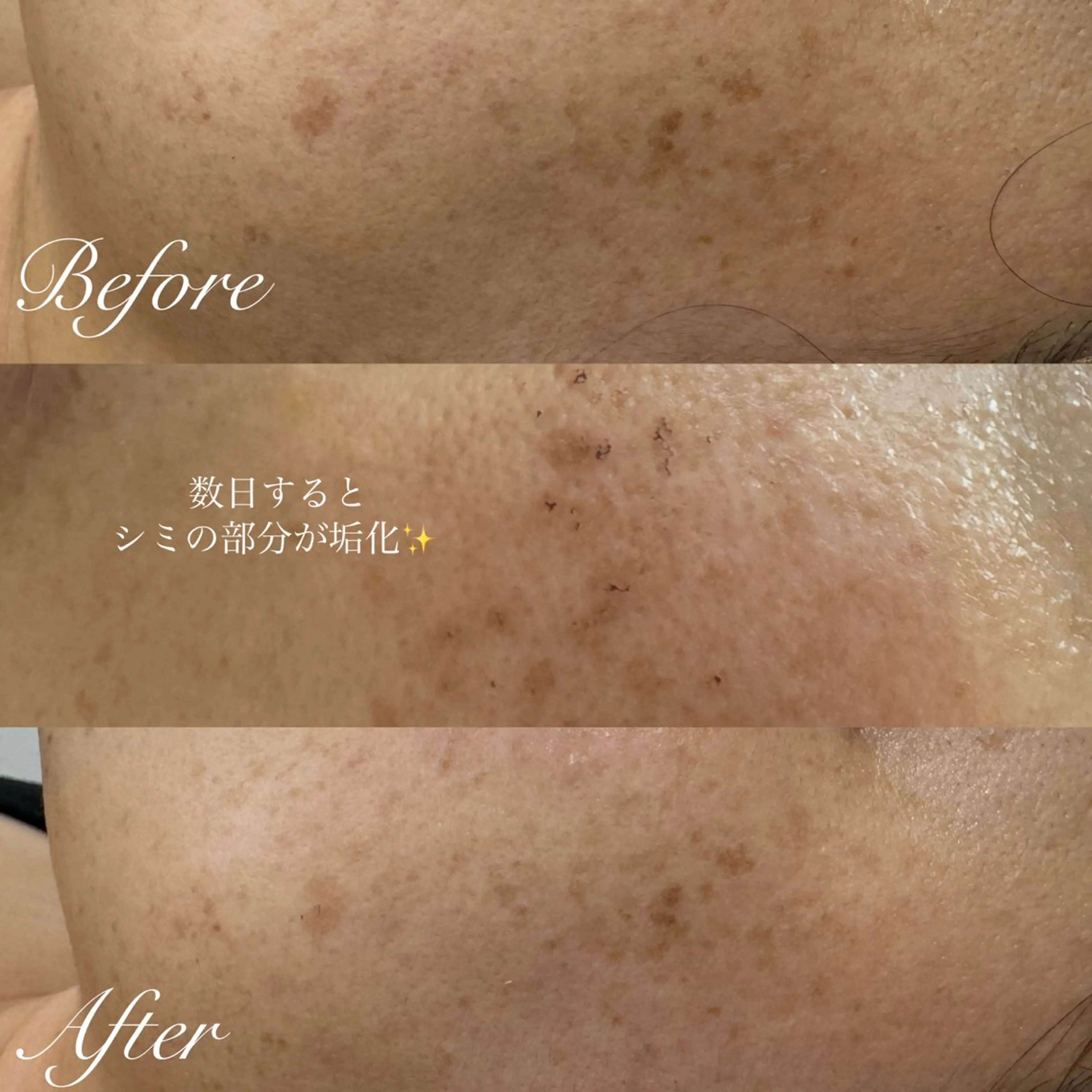 エステ シミ🩷ニキビ専門店 Matteo🎀✨のエステ・リラクイメージ