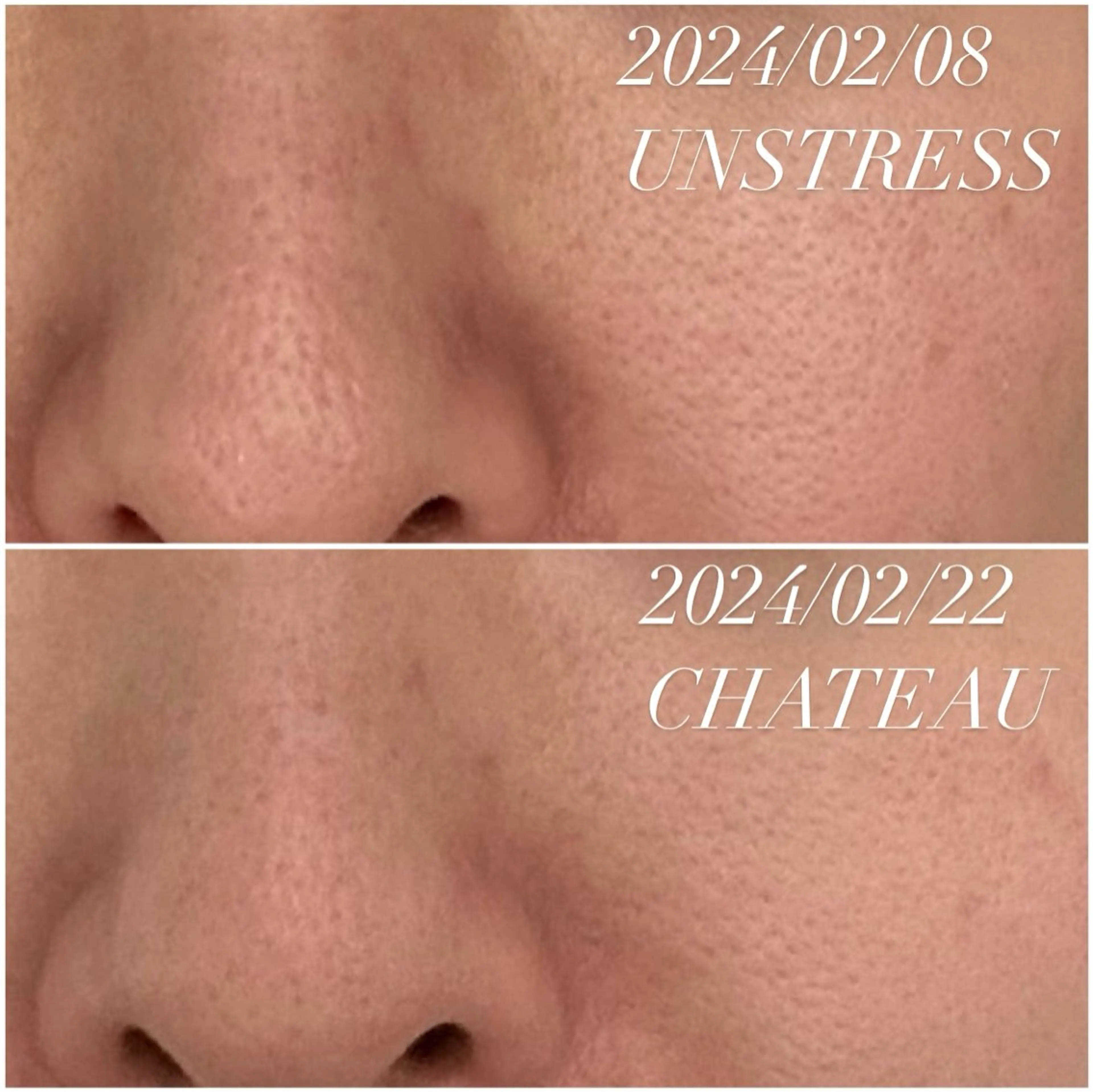 エステ 肌質改善|天王寺 For...はるかのエステ・リラクイメージ