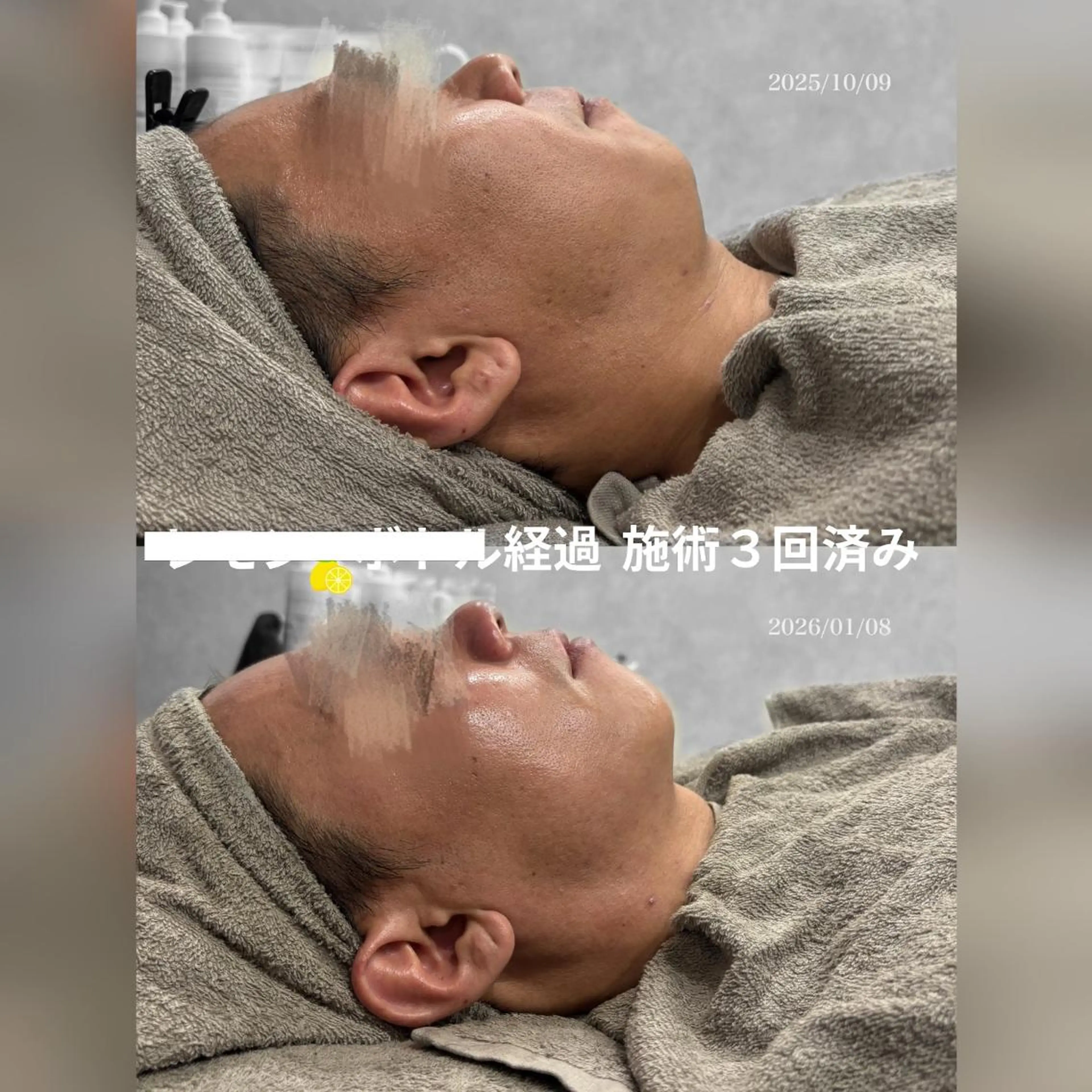 心斎橋🤍堀江.小顔 ハーブ.痩身クレビアのエステ・リラクイメージ