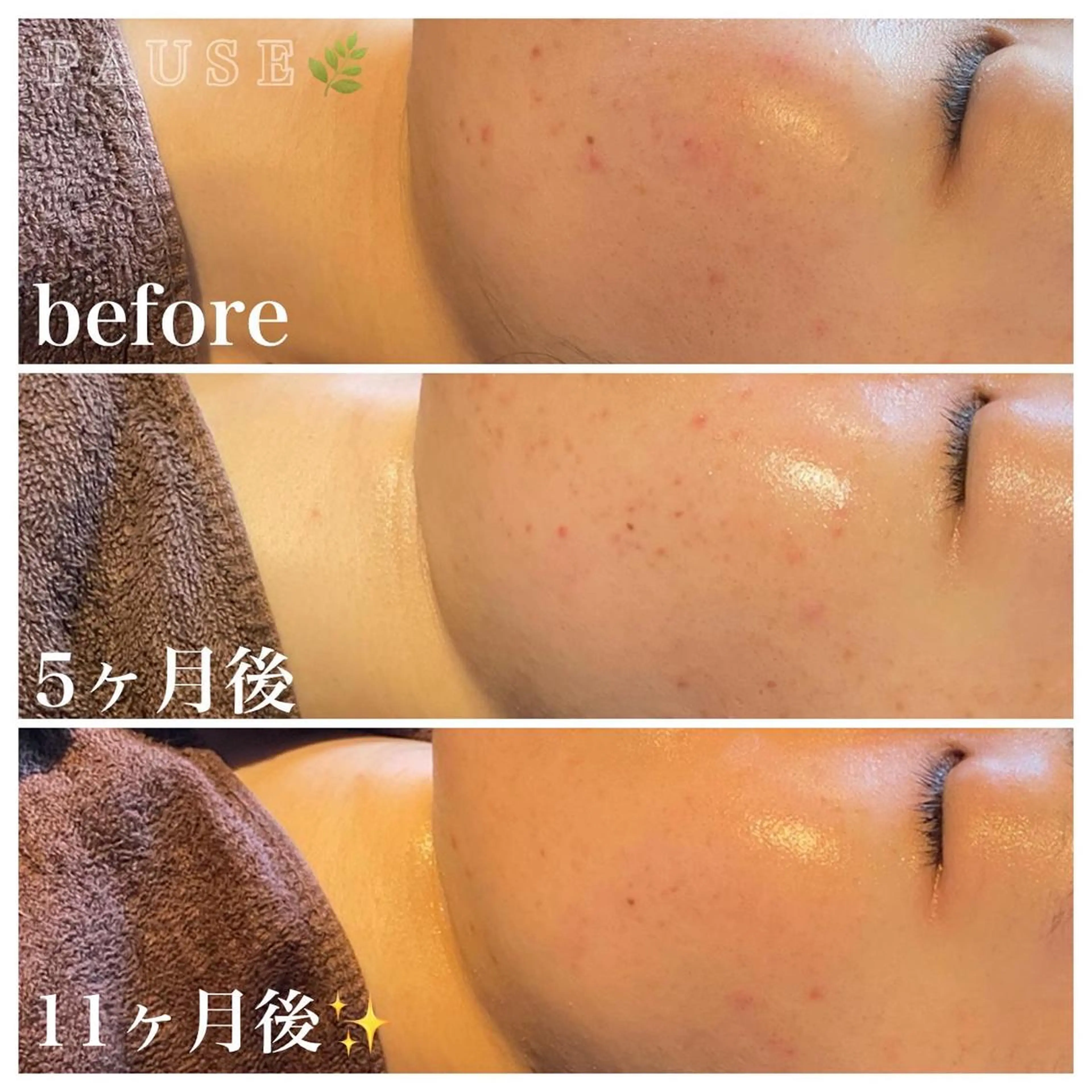 エステ 浜野 恵美のエステ・リラクイメージ