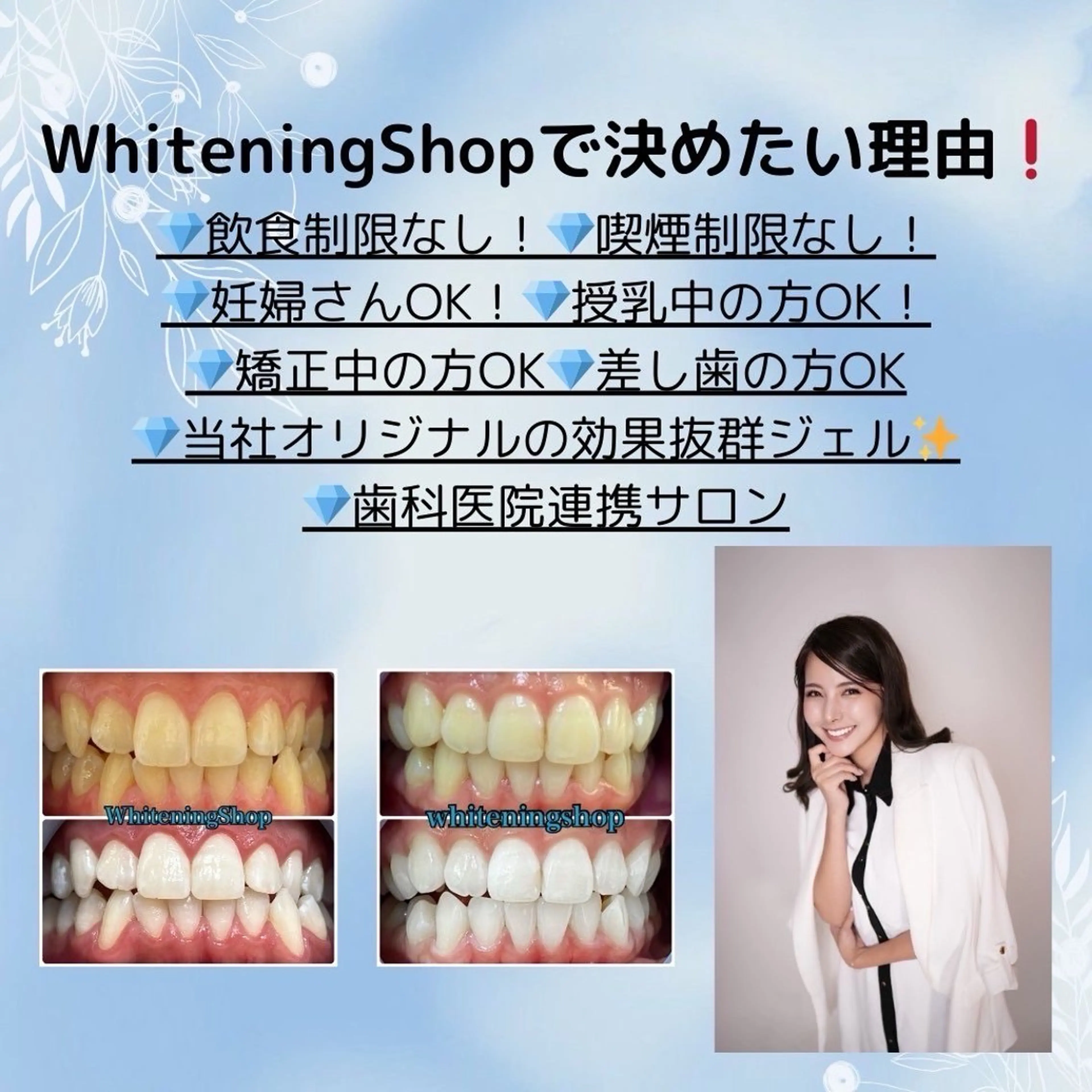 ホワイトニングショップ　四条店所属・ホワイトニング ショップ 四条店のエステ・リラクイメージ