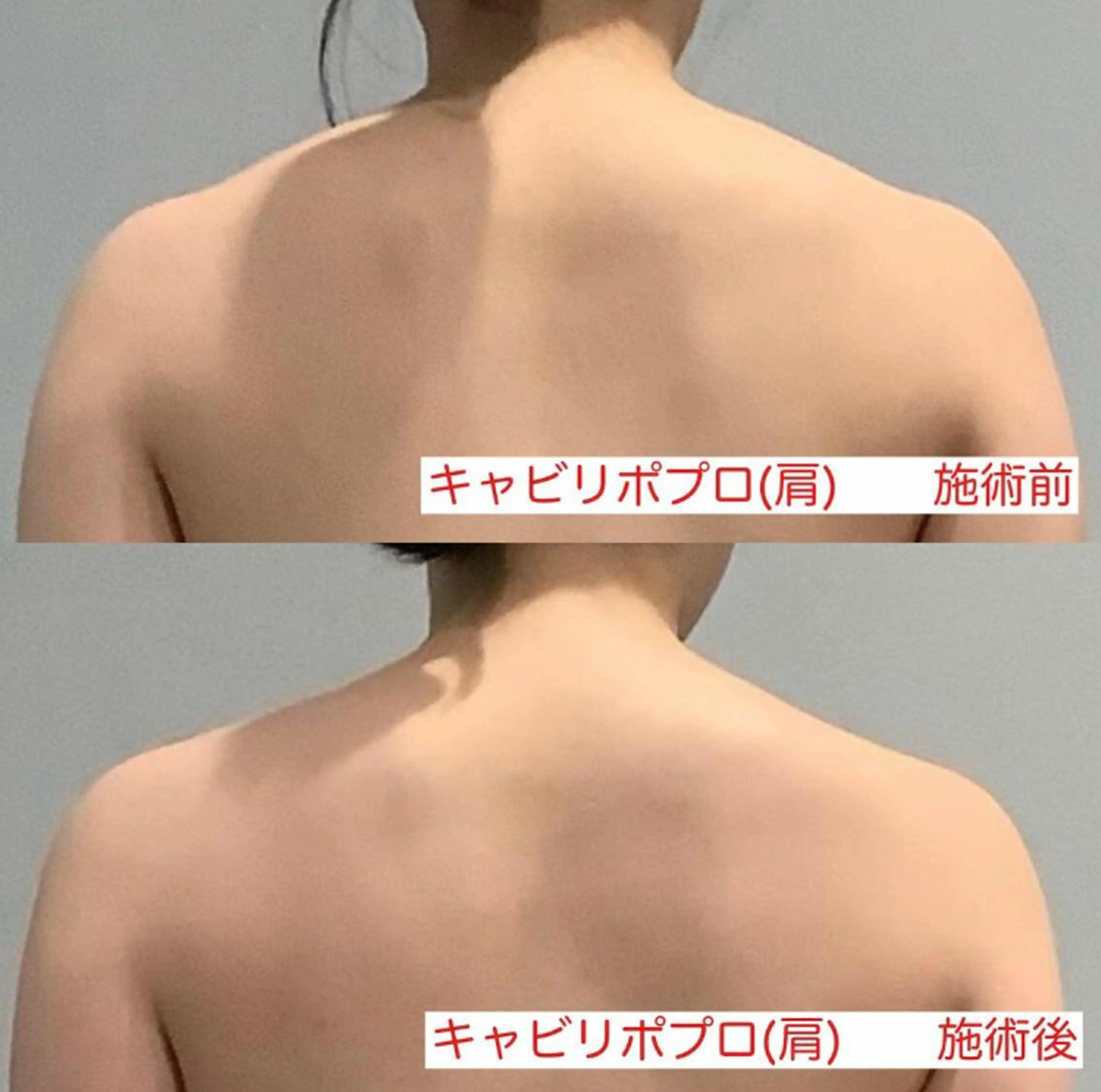 エステ エステサロン JURISのエステ・リラクイメージ