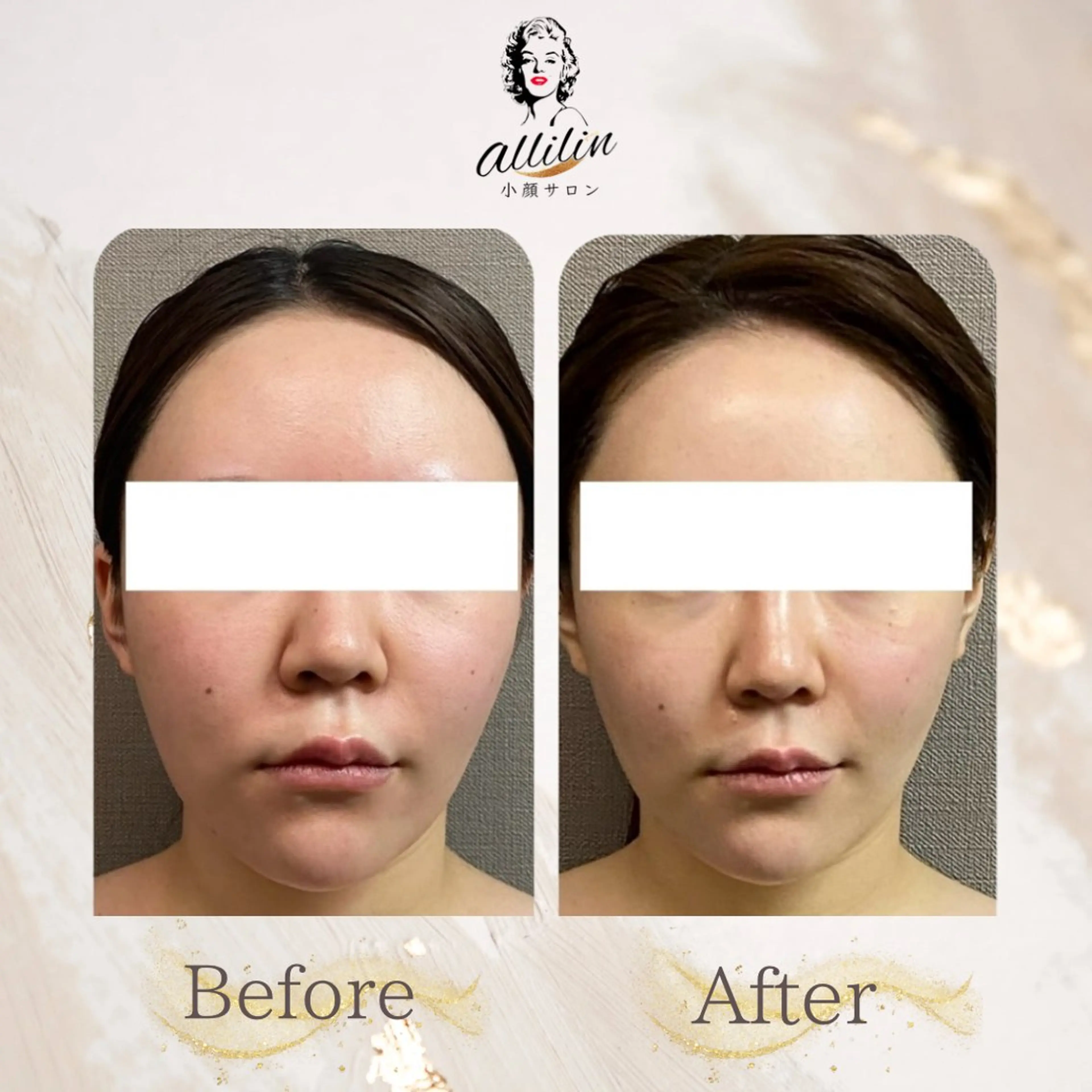 小顔サロンallilin所属・💎allilin 五所川原💎本間のエステ・リラクイメージ