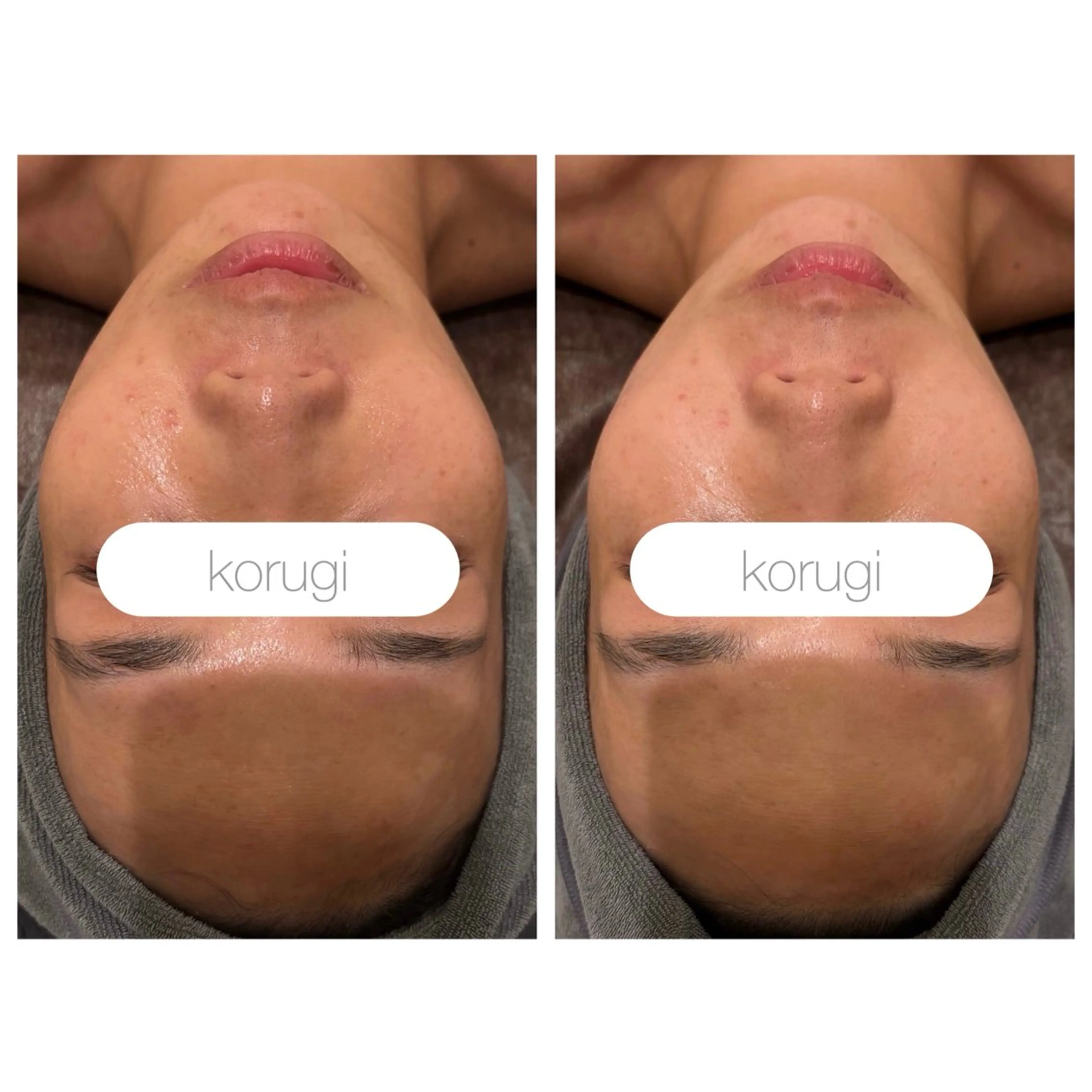 エステ 小顔コルギ ☆表参道/外苑前のエステ・リラクイメージ