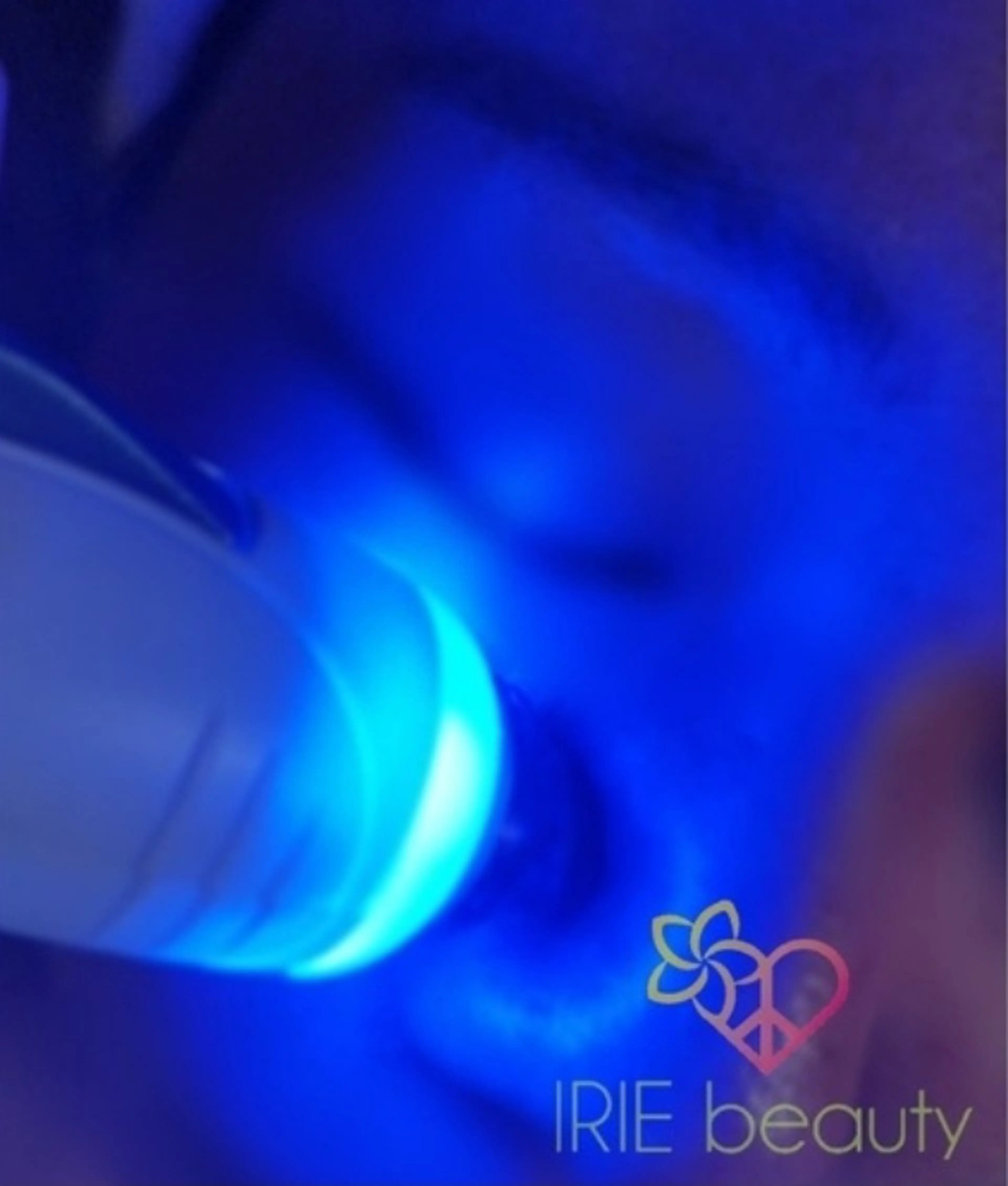 ハイドロ毛穴洗浄コースの写真