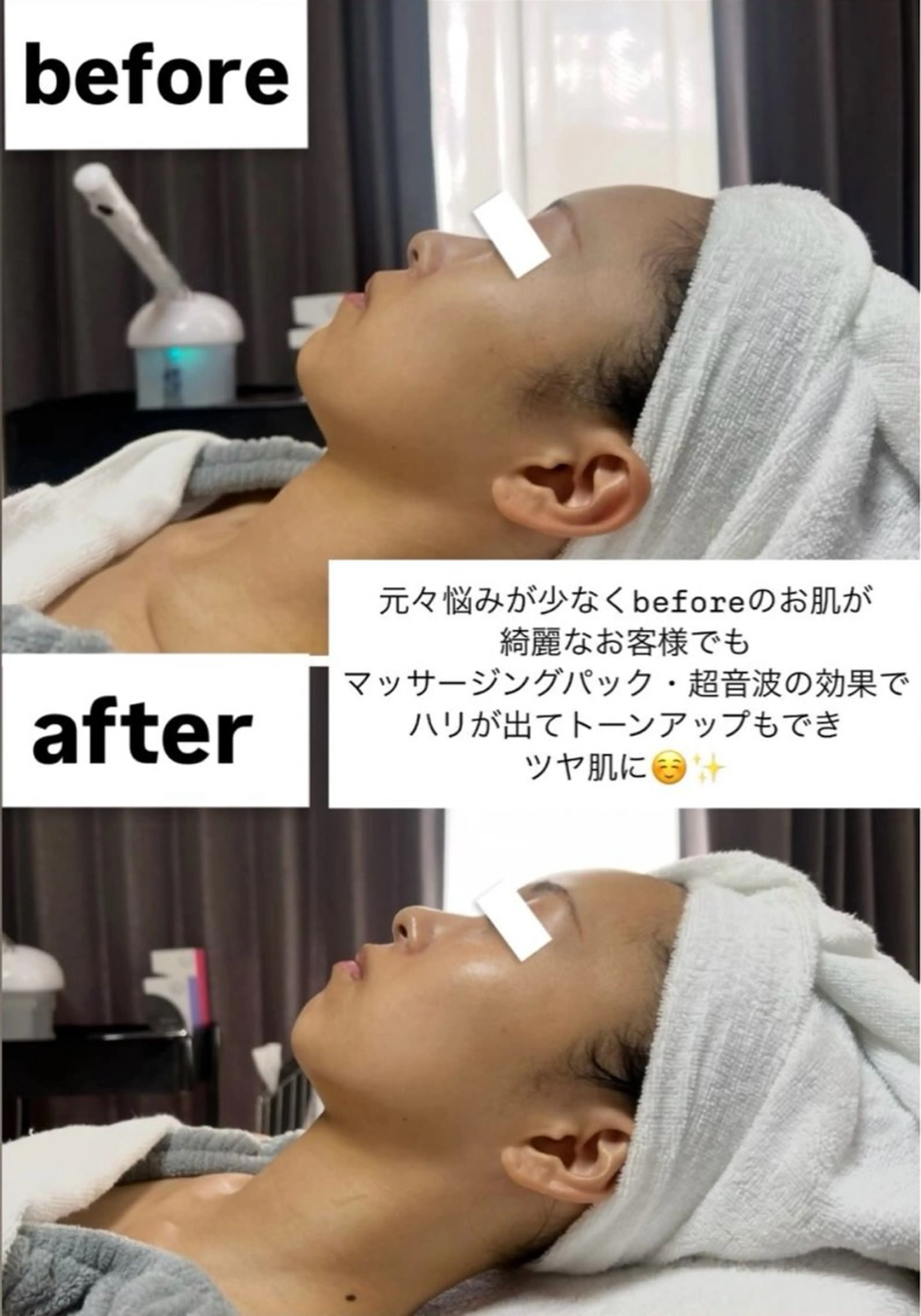 エステ ROR Akariのエステ・リラクイメージ