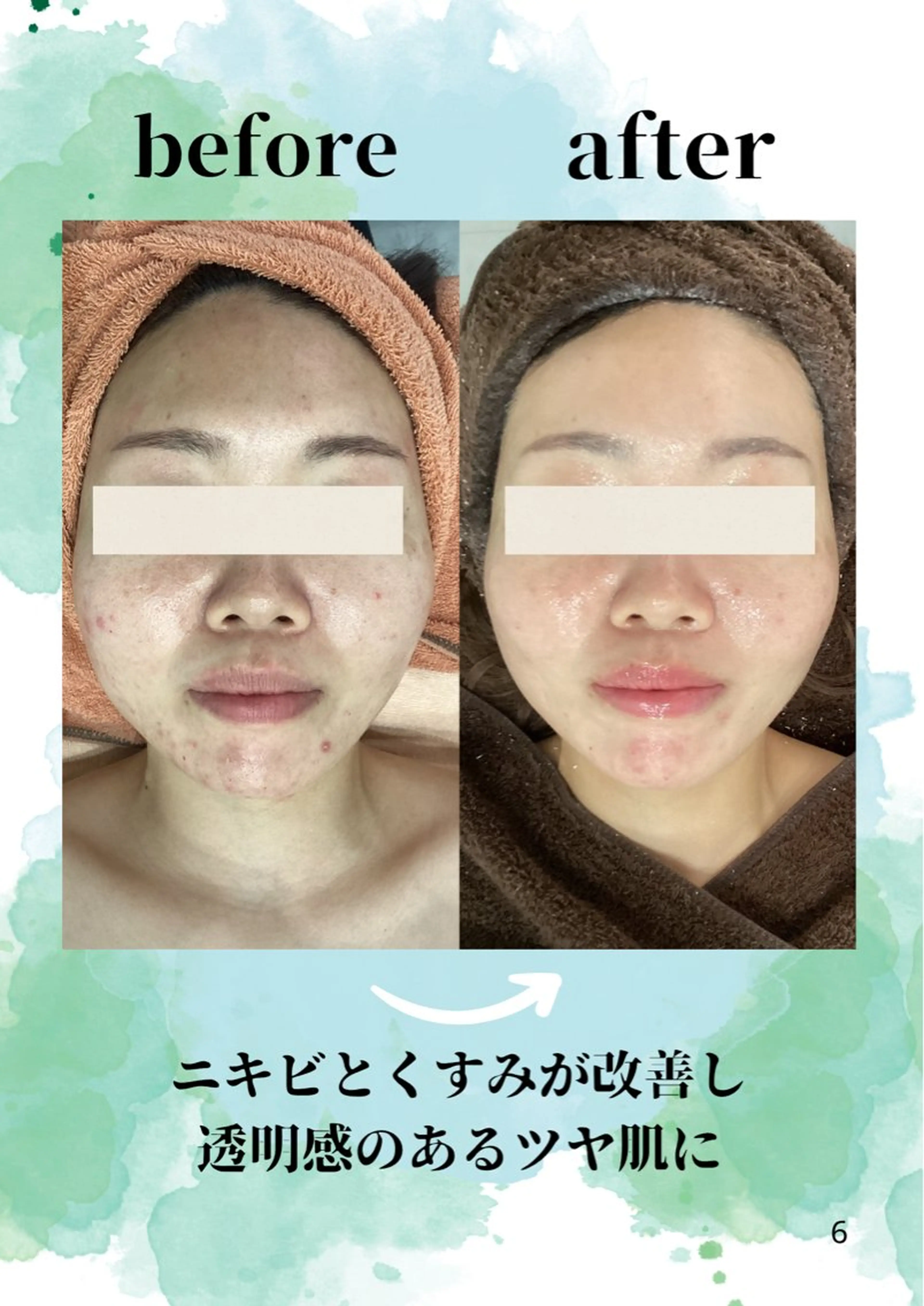 エステ♡Eden Asamiのエステ・リラクイメージ