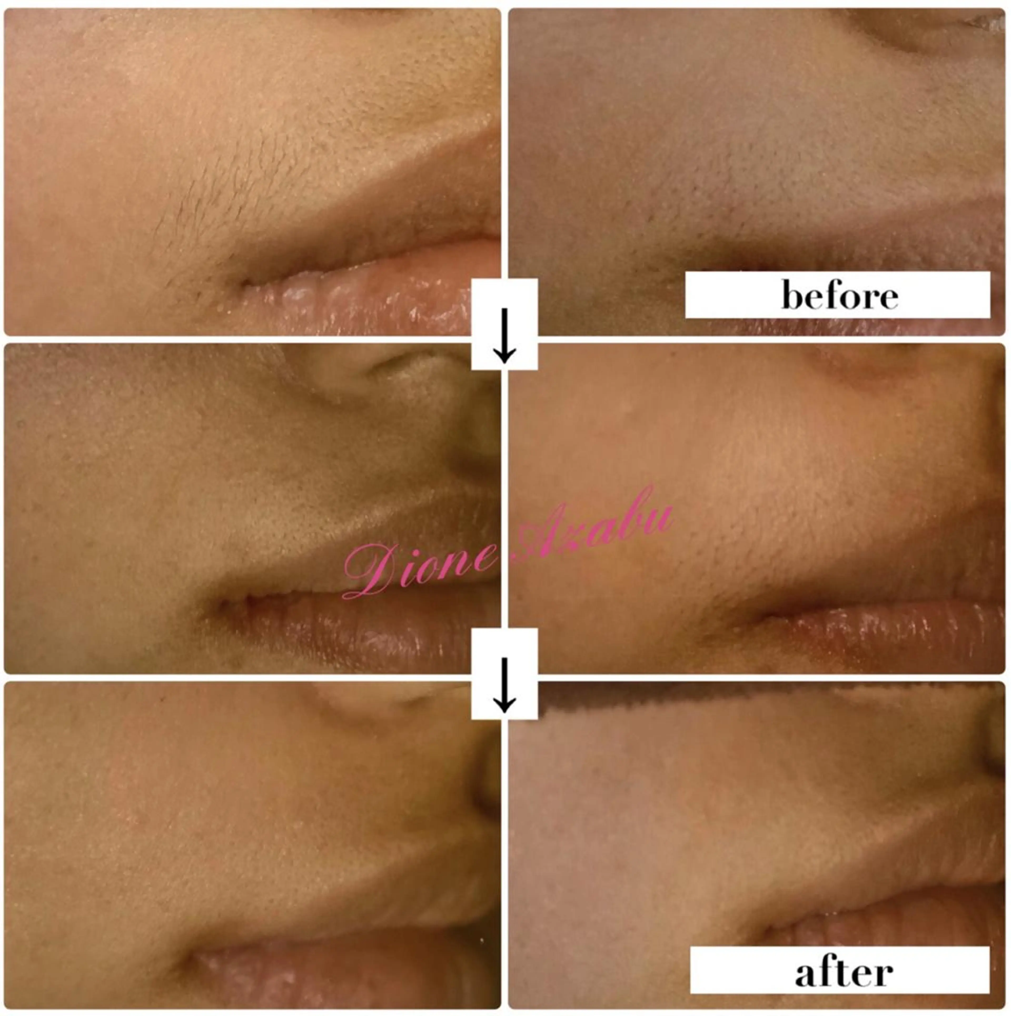 DIONE 麻布十番店のエステ・リラクイメージ