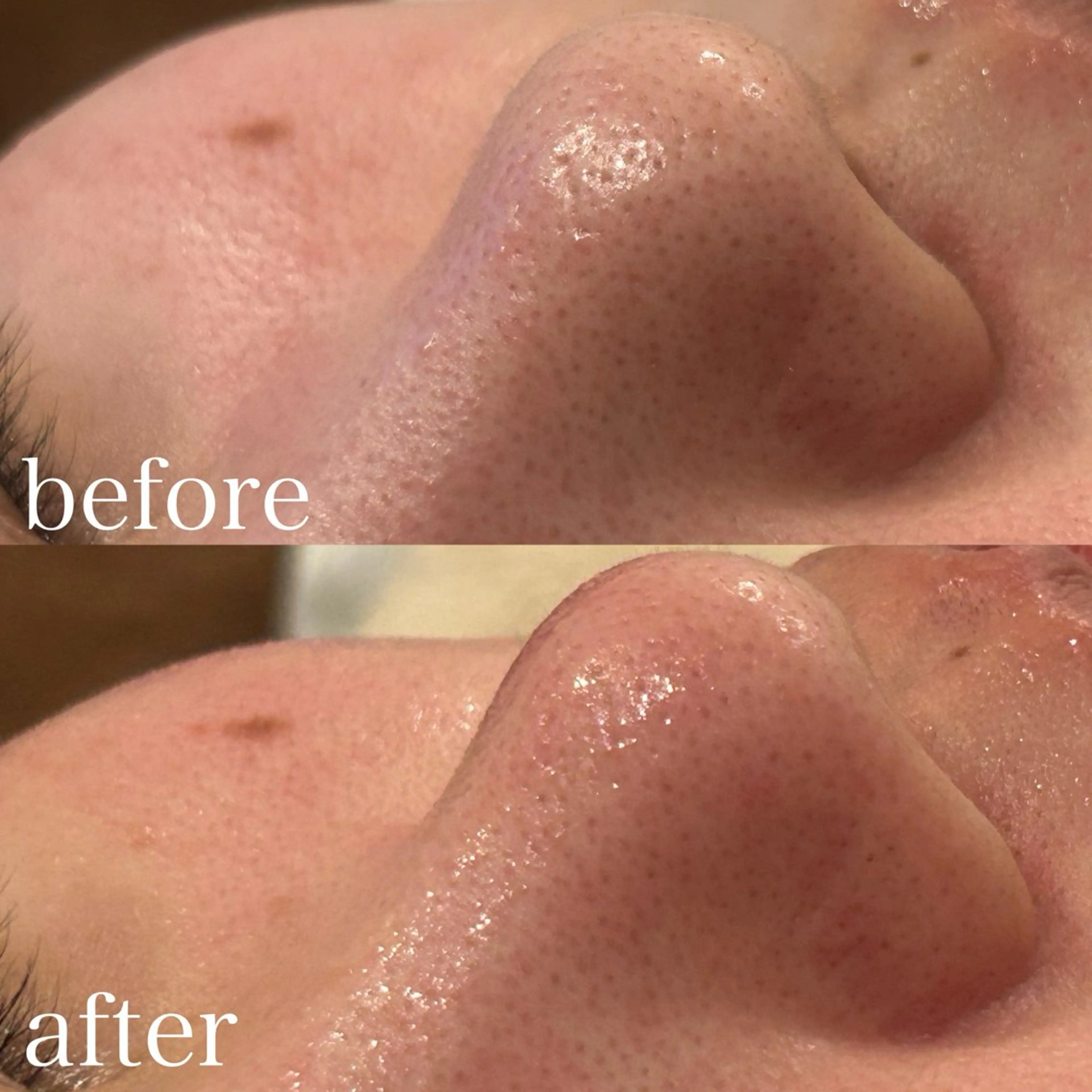 エステ 【Beauel】 ここあのエステ・リラクイメージ