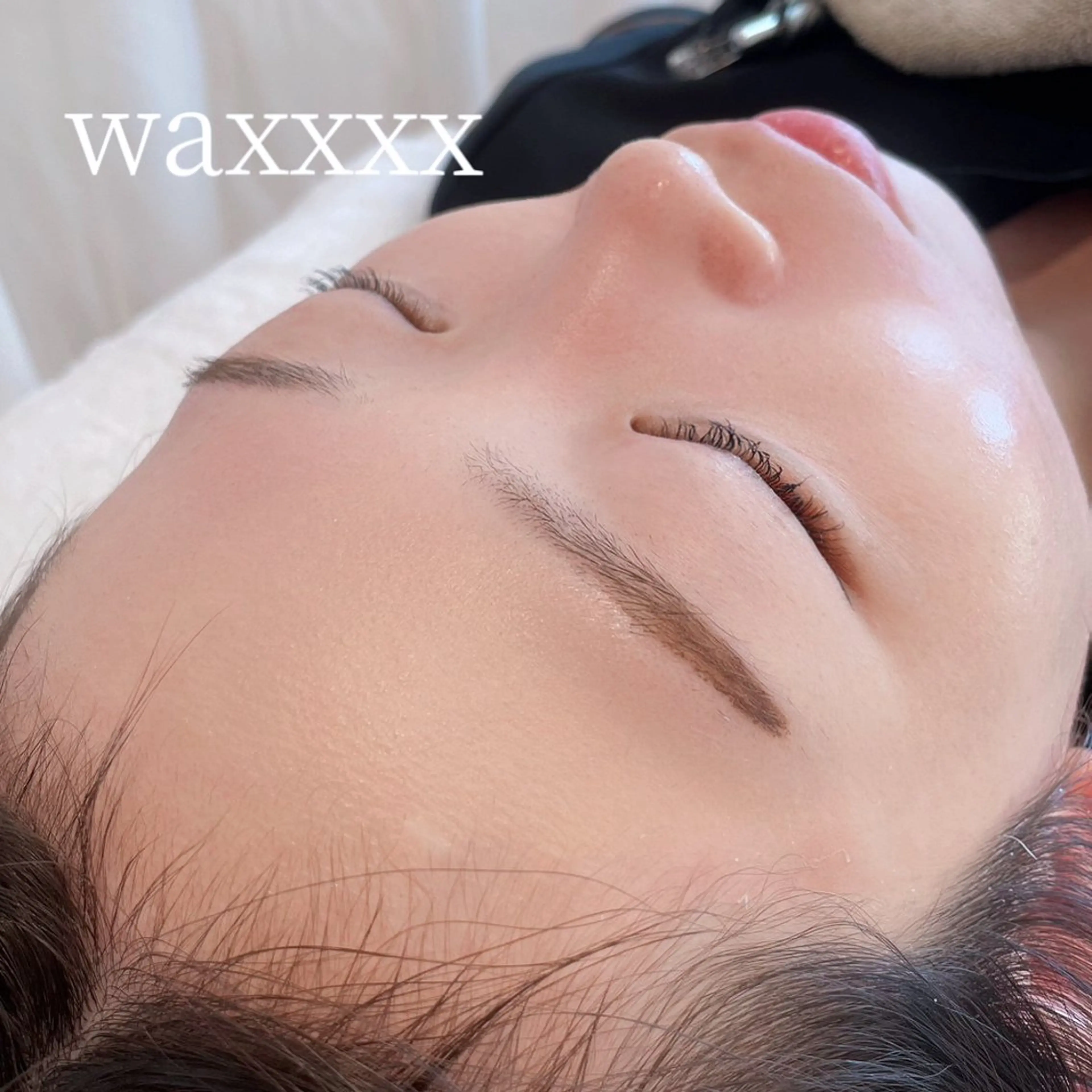 ムダ毛・角質ゼロの美肌へ💕waxxxx(フェイシャルワックス脱毛)🪞✨️✨️の写真