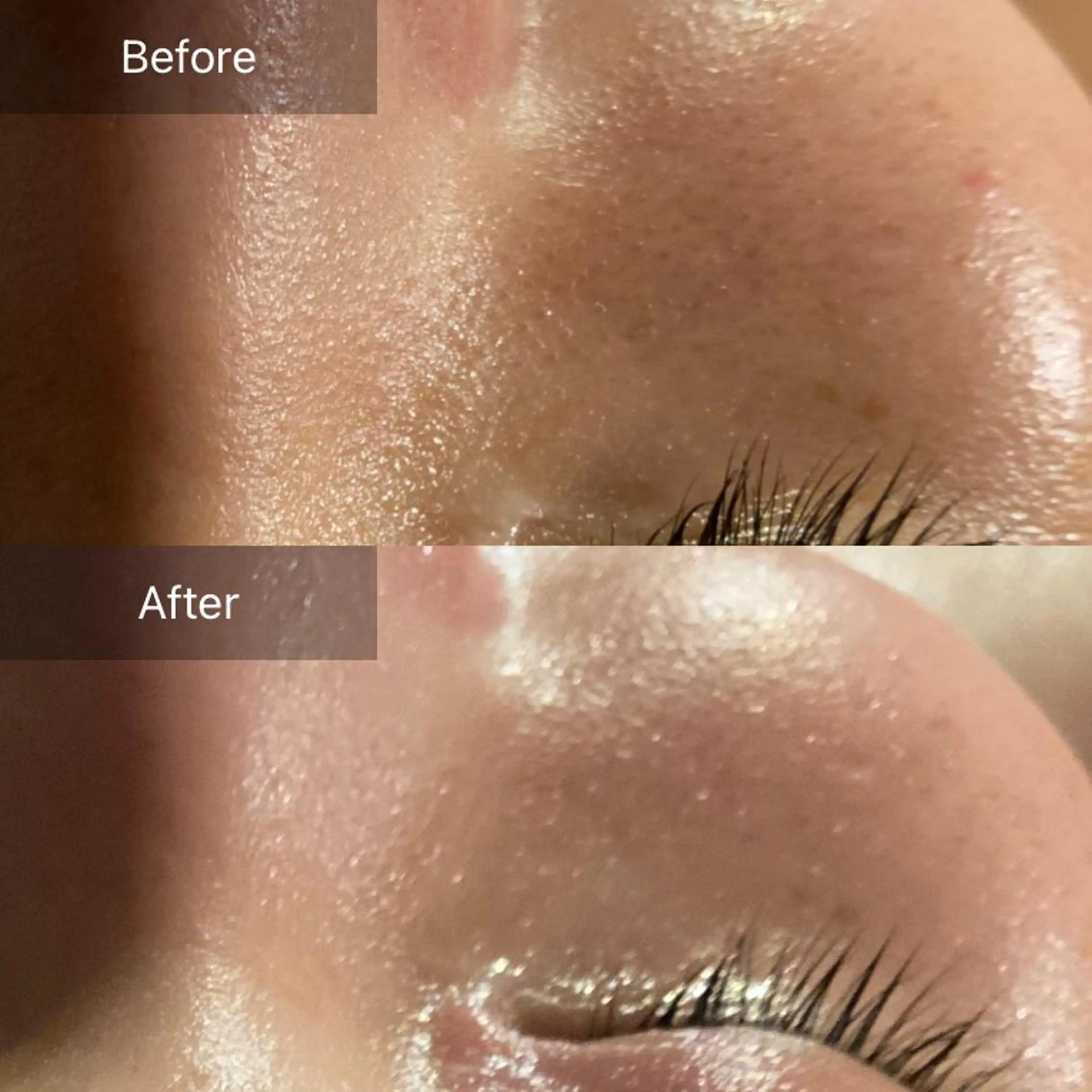 エステ リラク Mandarin Orange所属・毛穴から始める肌メン テマンダリンオレンジのエステ・リラクイメージ