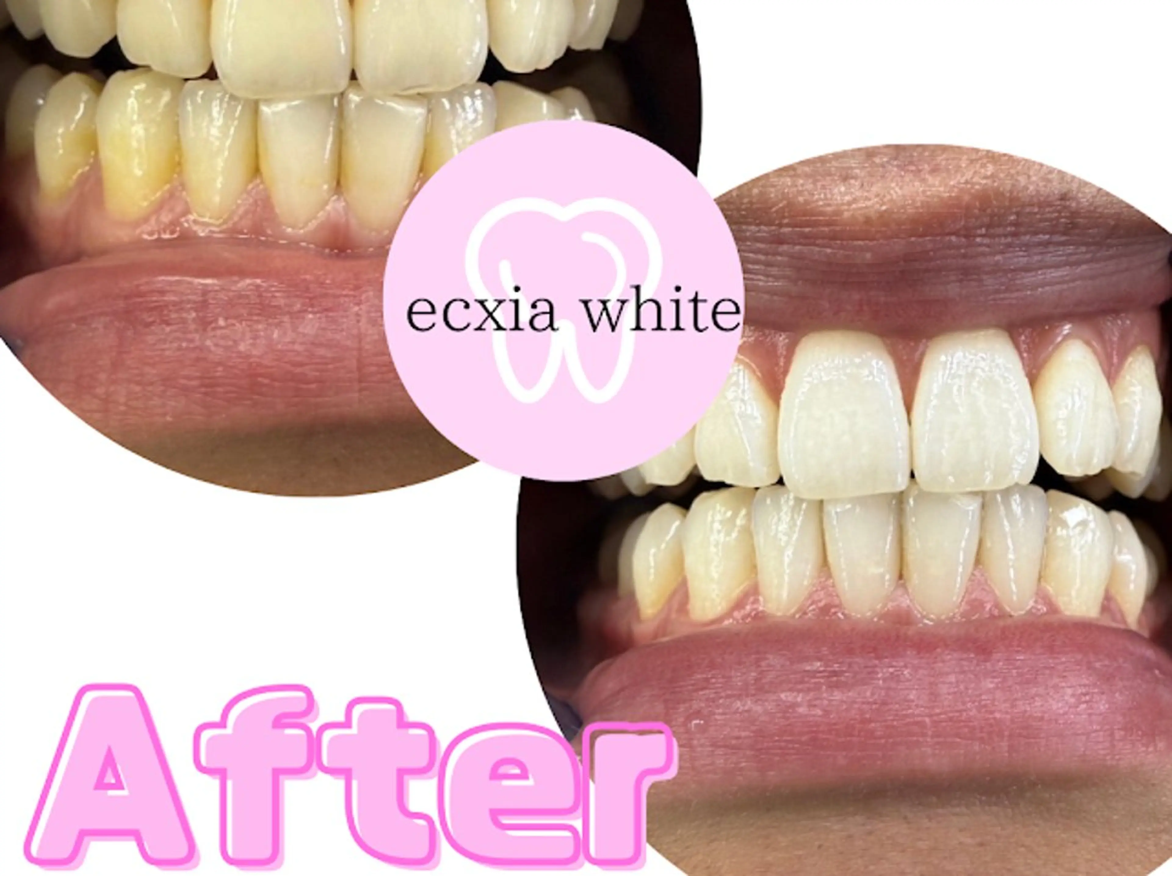 エステ セルフホワイトニング エクシア浜松店のエステ・リラクイメージ