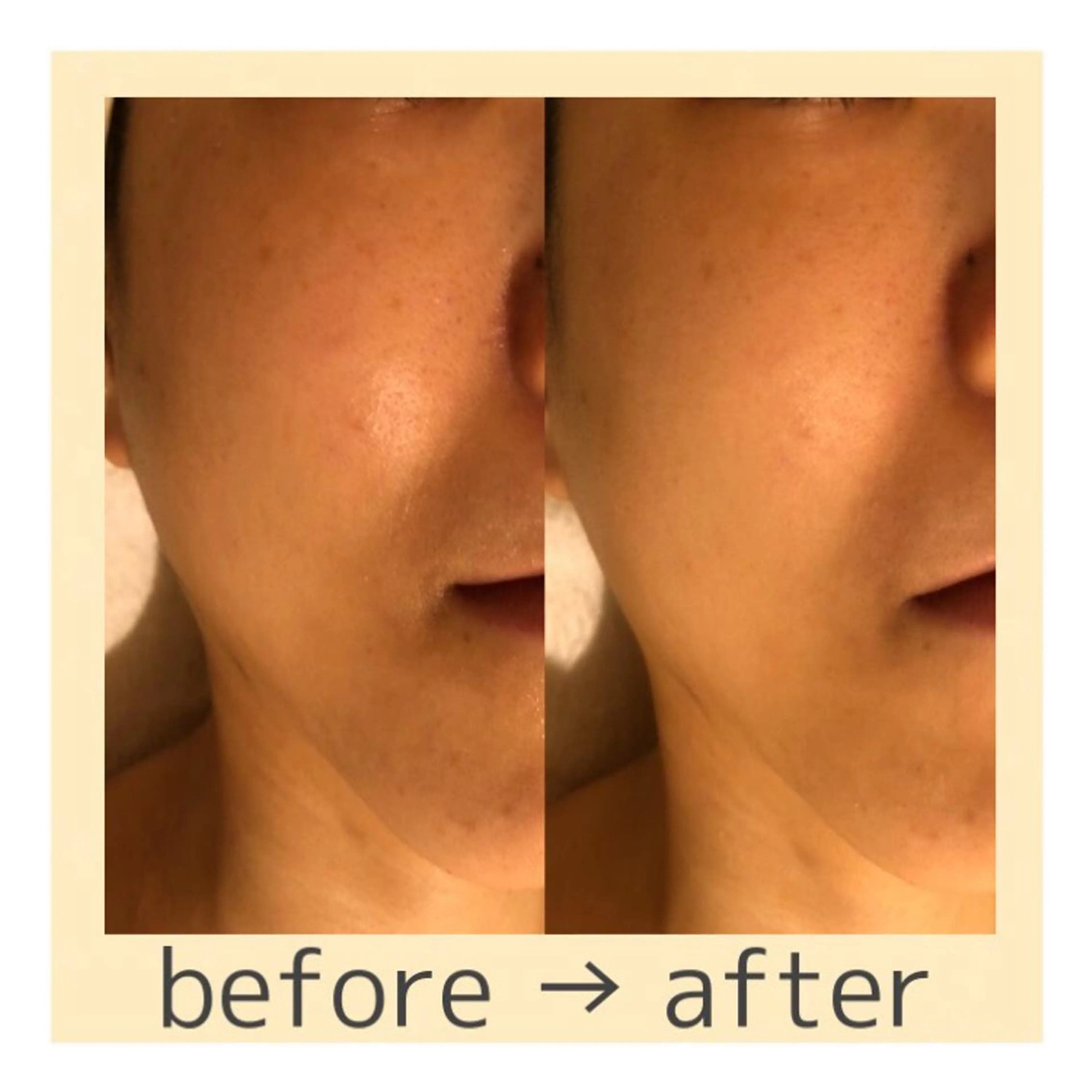 大人の 毛穴ケア専門店のその他イメージ