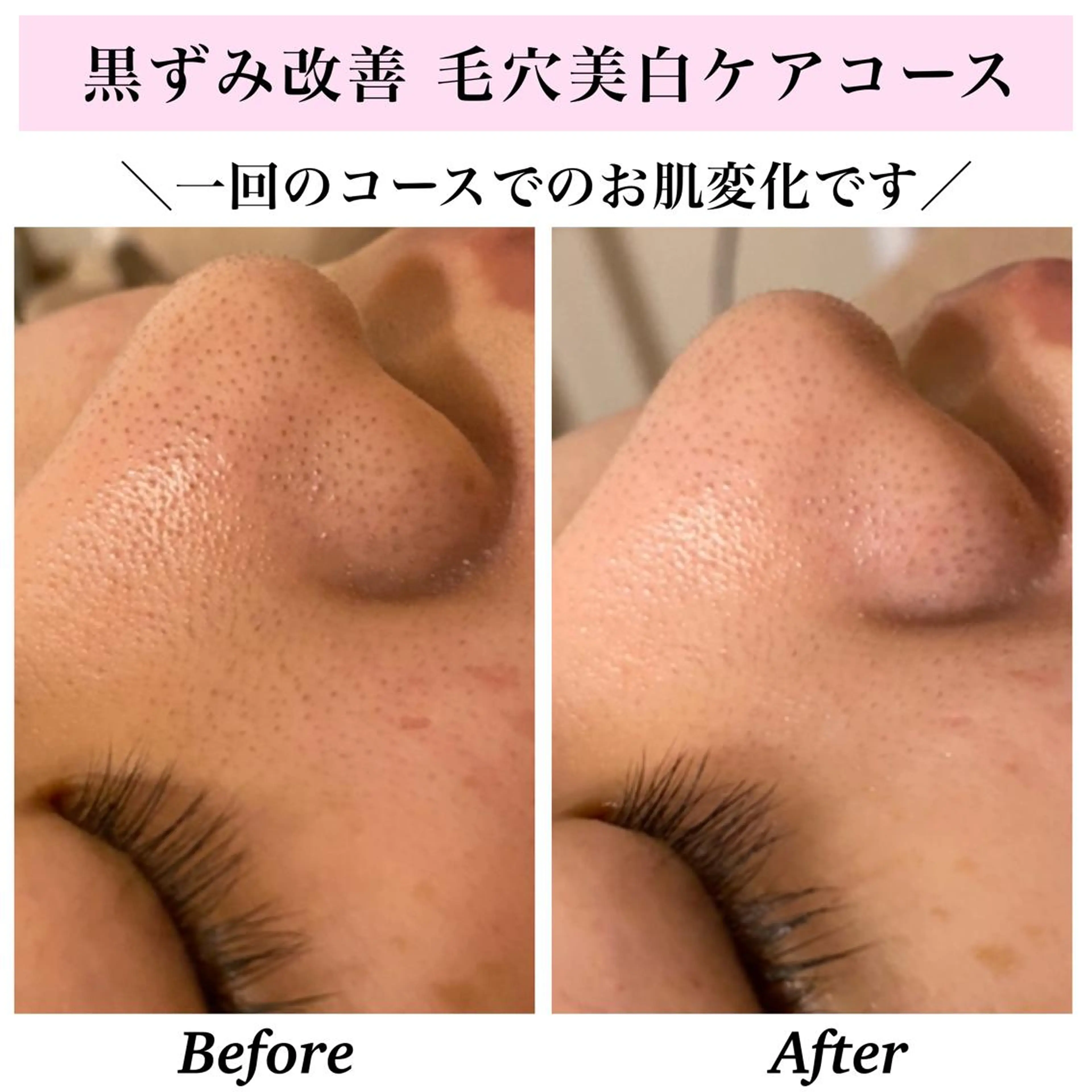 エステ リラク Bellesthe （ベルエステ）のエステ・リラクイメージ