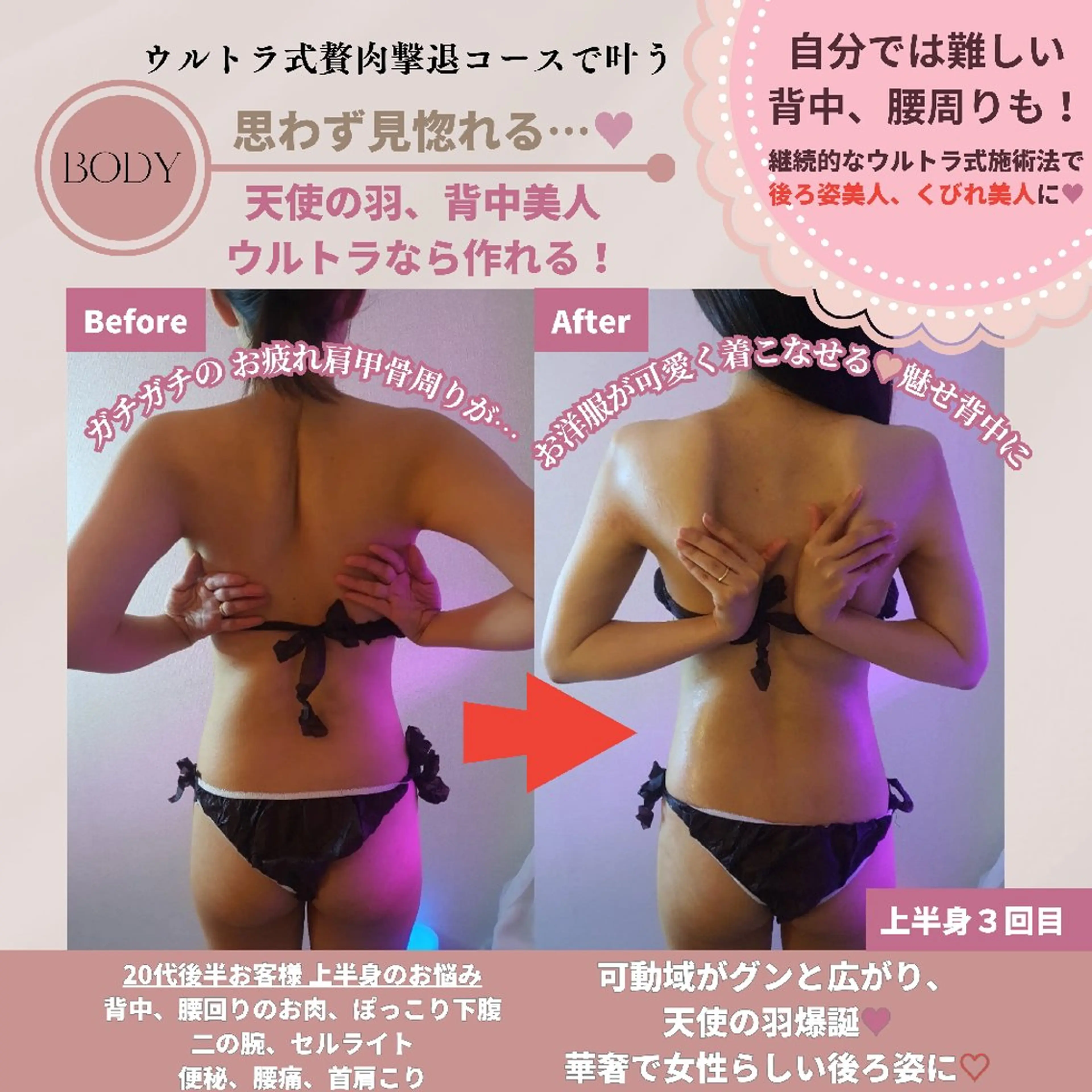 痩身ハーブピーリング 筋膜リリース☆B&Hのエステ・リラクイメージ