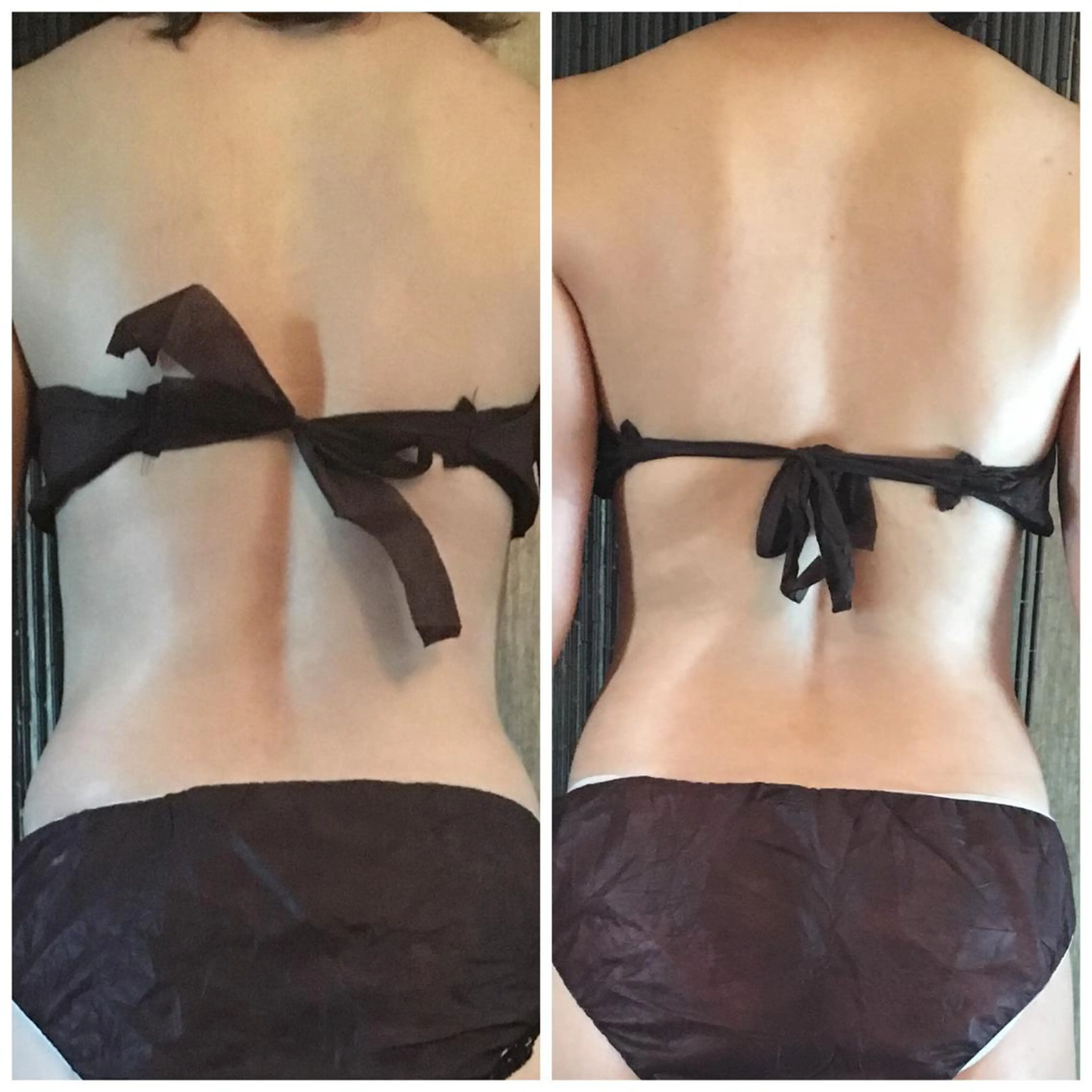 贅沢まるごと全身速攻痩せコースの写真