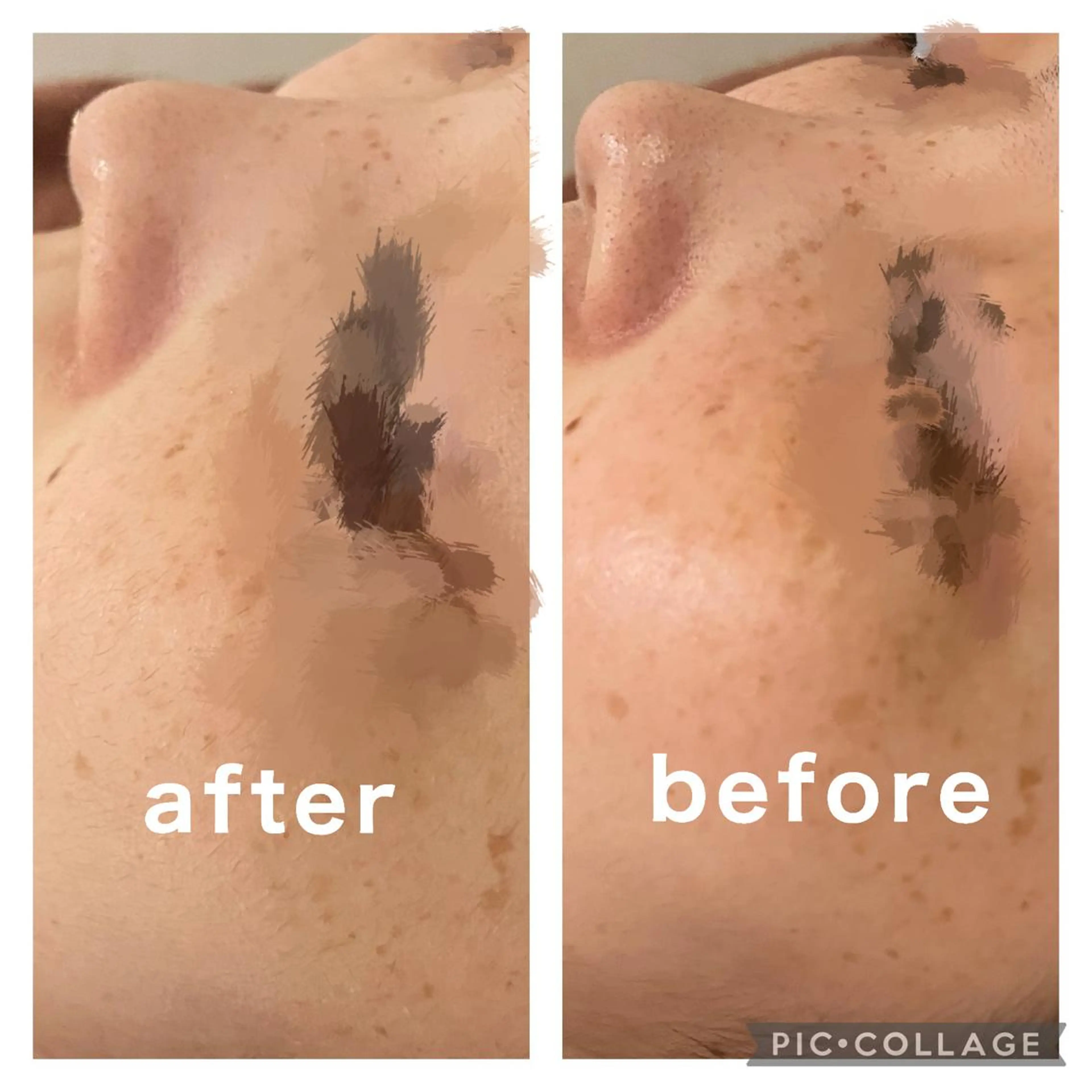 セミロング カラー パーマ ヘアアレンジ メンズ キッズ ネイル マツエク・マツパ アイブロウ エステ リラク ニキビ特化型エステ 🍓最短で肌質改善のその他イメージ