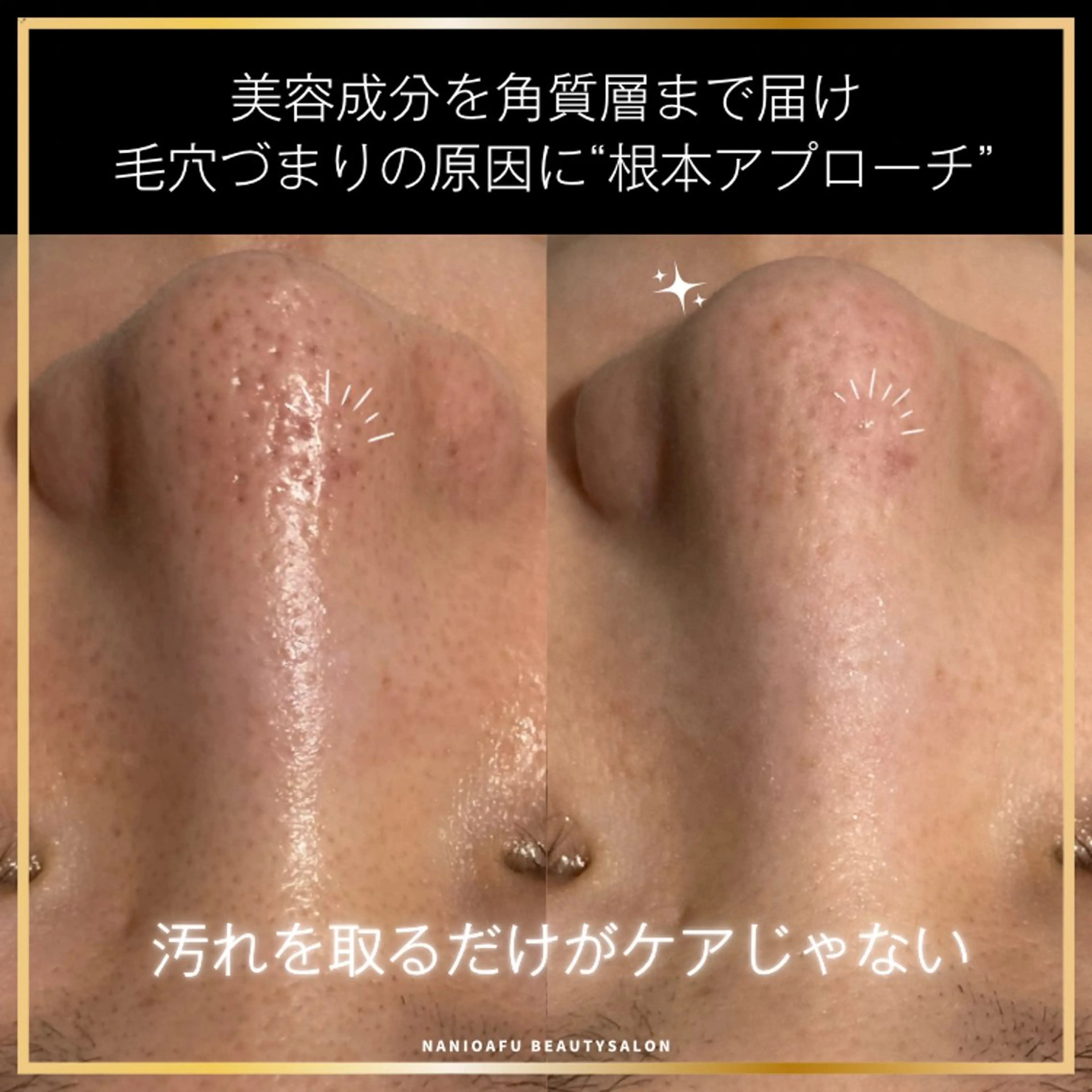 NANI OAFU所属・NANIOAFU [なんば店］のその他イメージ