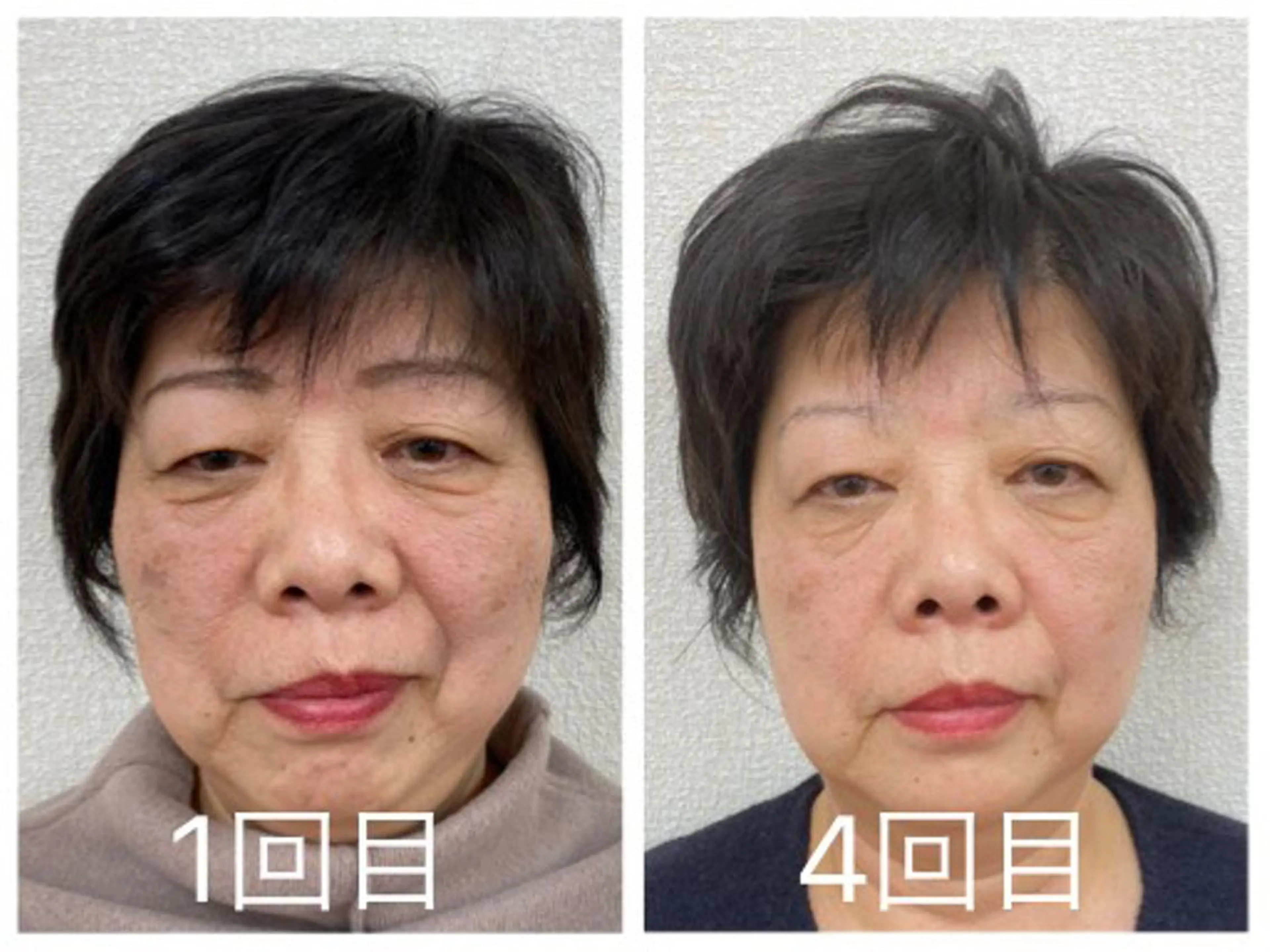 小顔矯正サロンLily所属・小顔矯正サロン Lilyのエステ・リラクイメージ