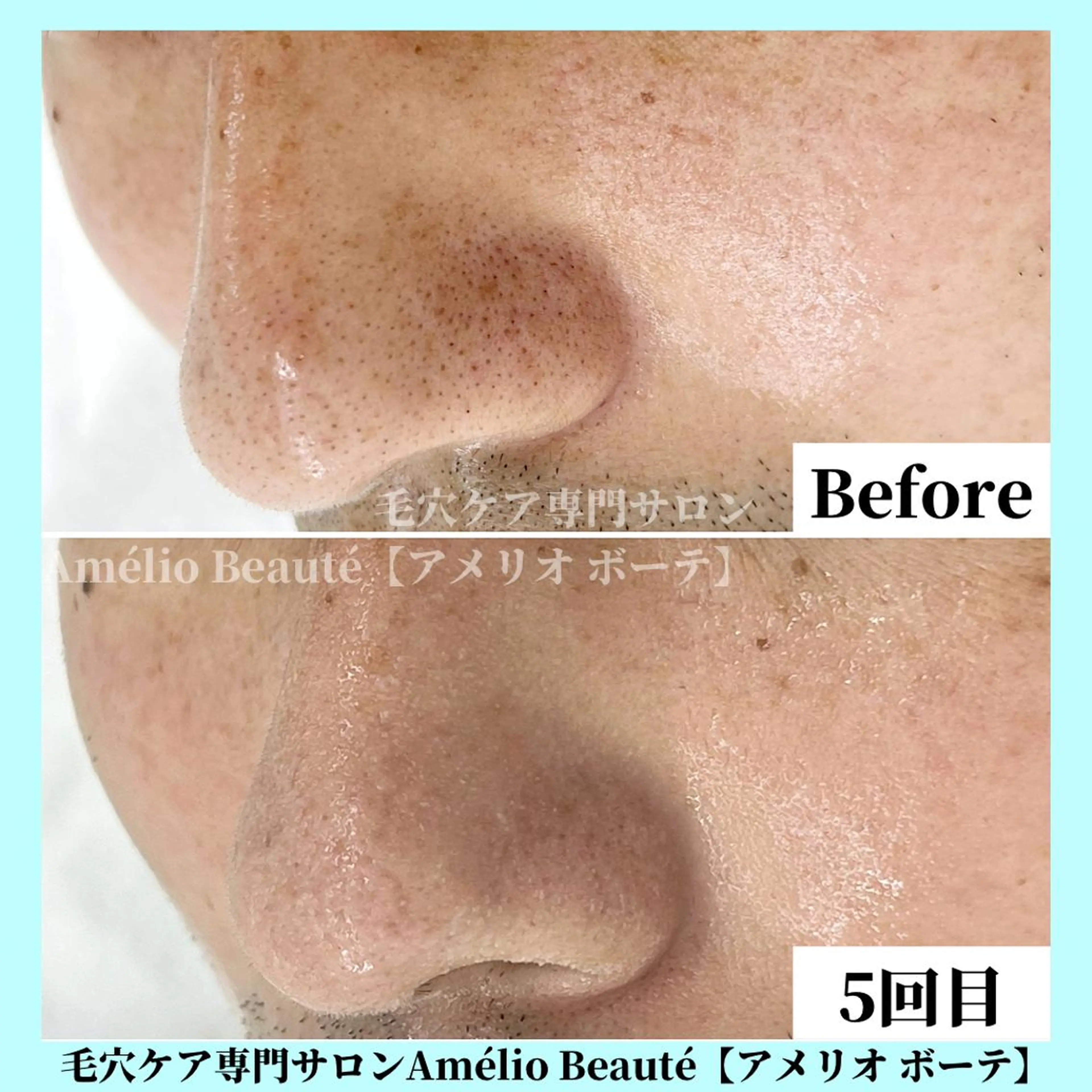 毛穴ケア専門サロン Amélio Beauté所属・毛穴ケア専門サロン アメリオボーテのその他イメージ