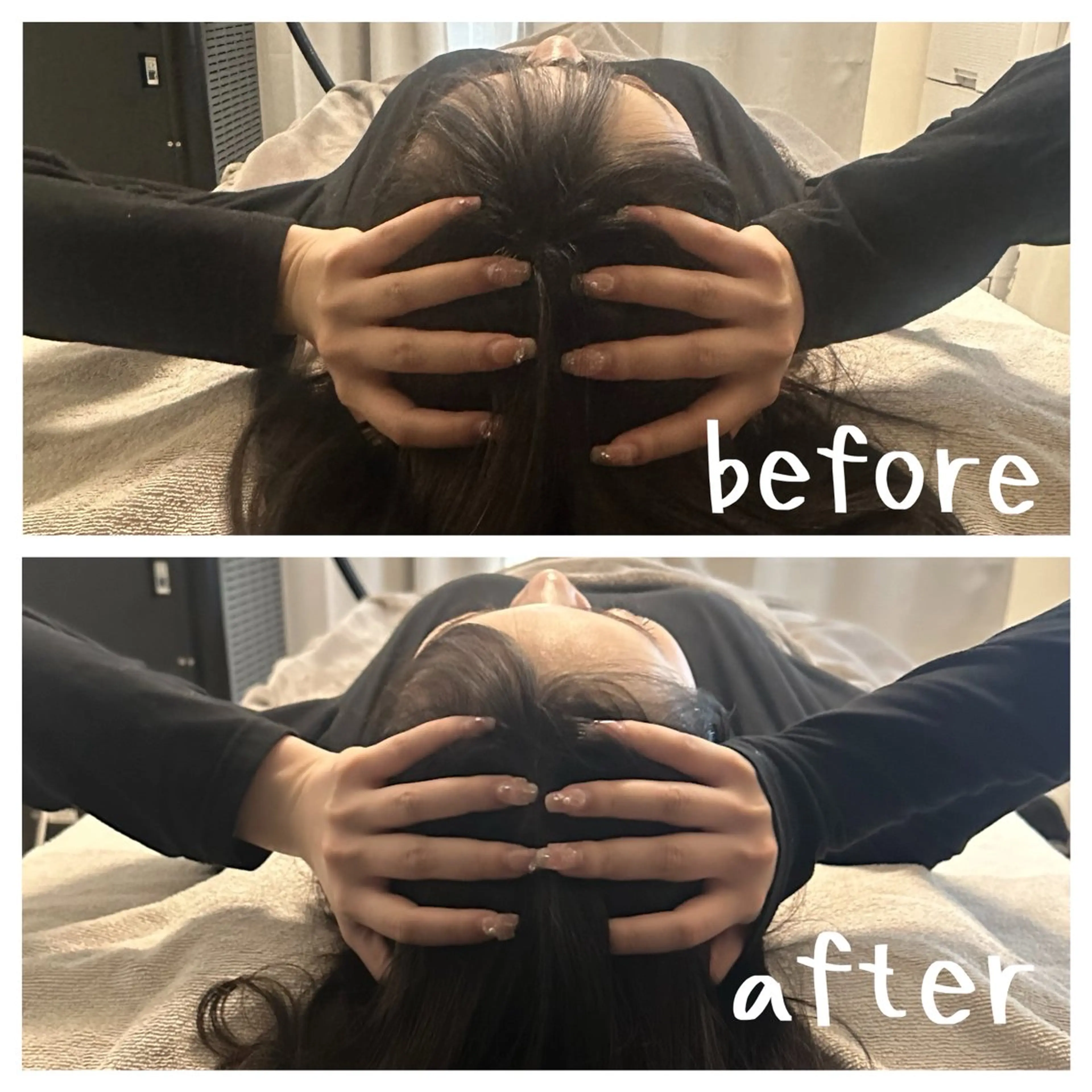 医療提携×美容整体 小顔ハイフピーリングのエステ・リラクイメージ