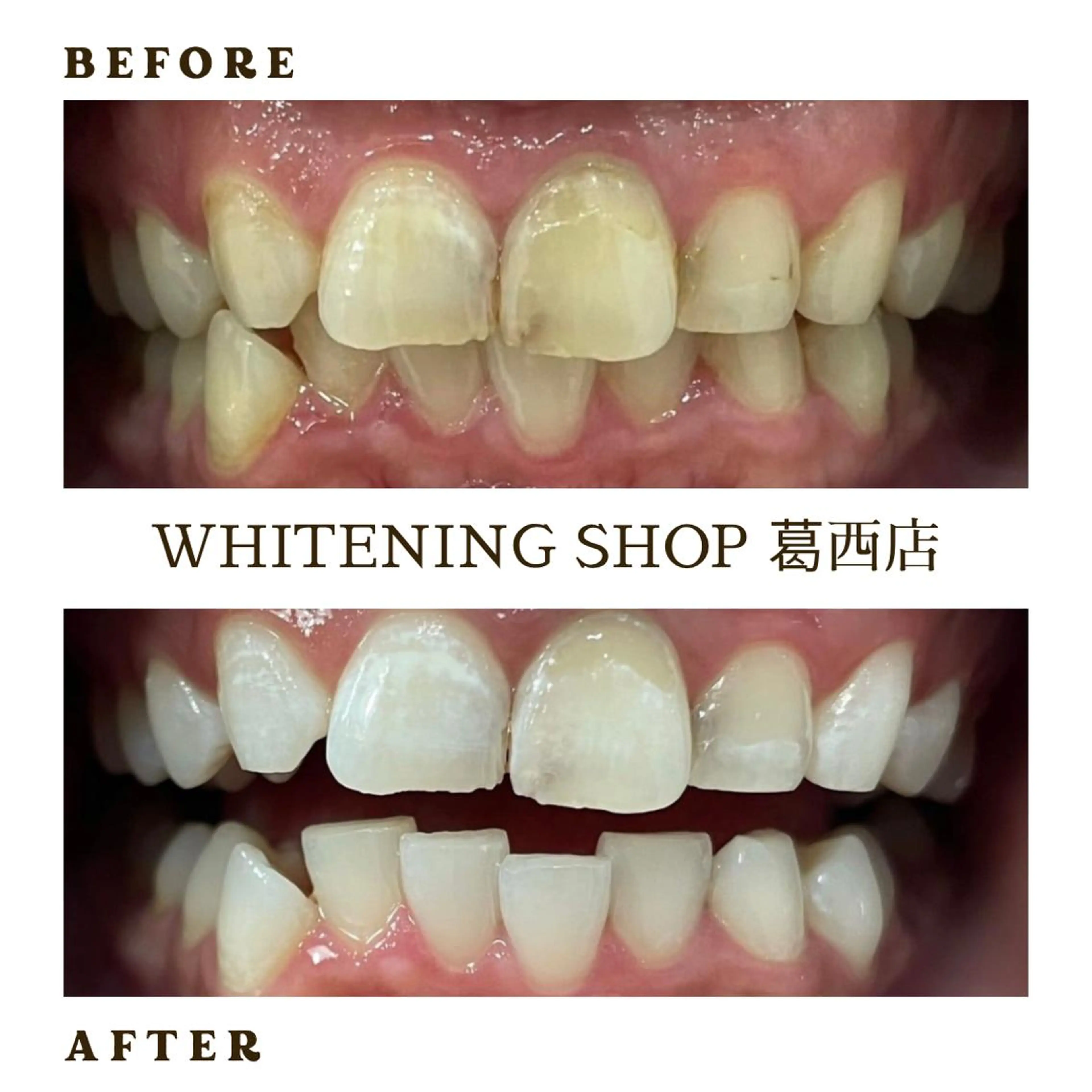 メンズ その他 ホワイトニング ショップ葛西店のその他イメージ