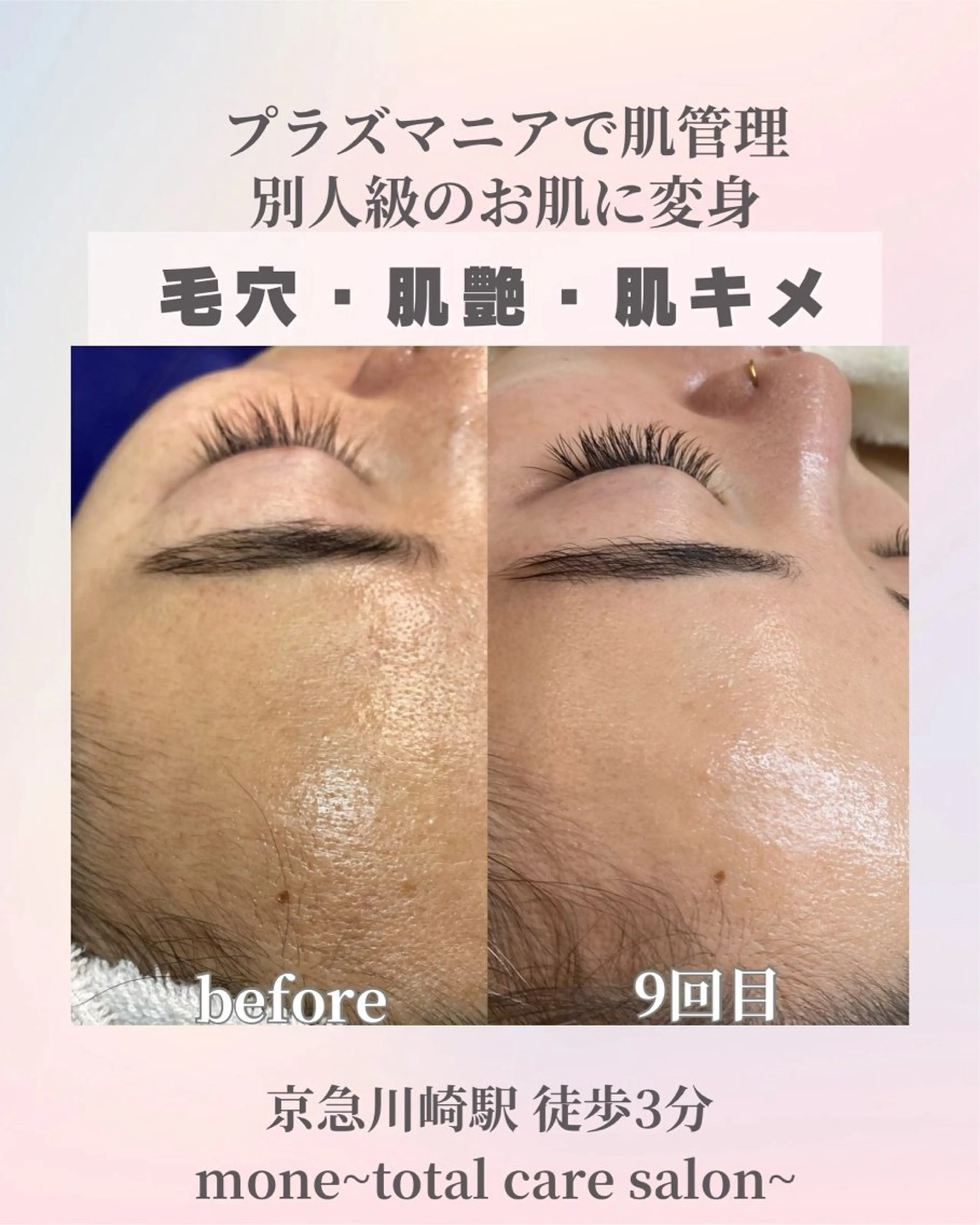 エステ mone~total care salon~所属・mone (モーネ)のマツエク・マツパデザイン