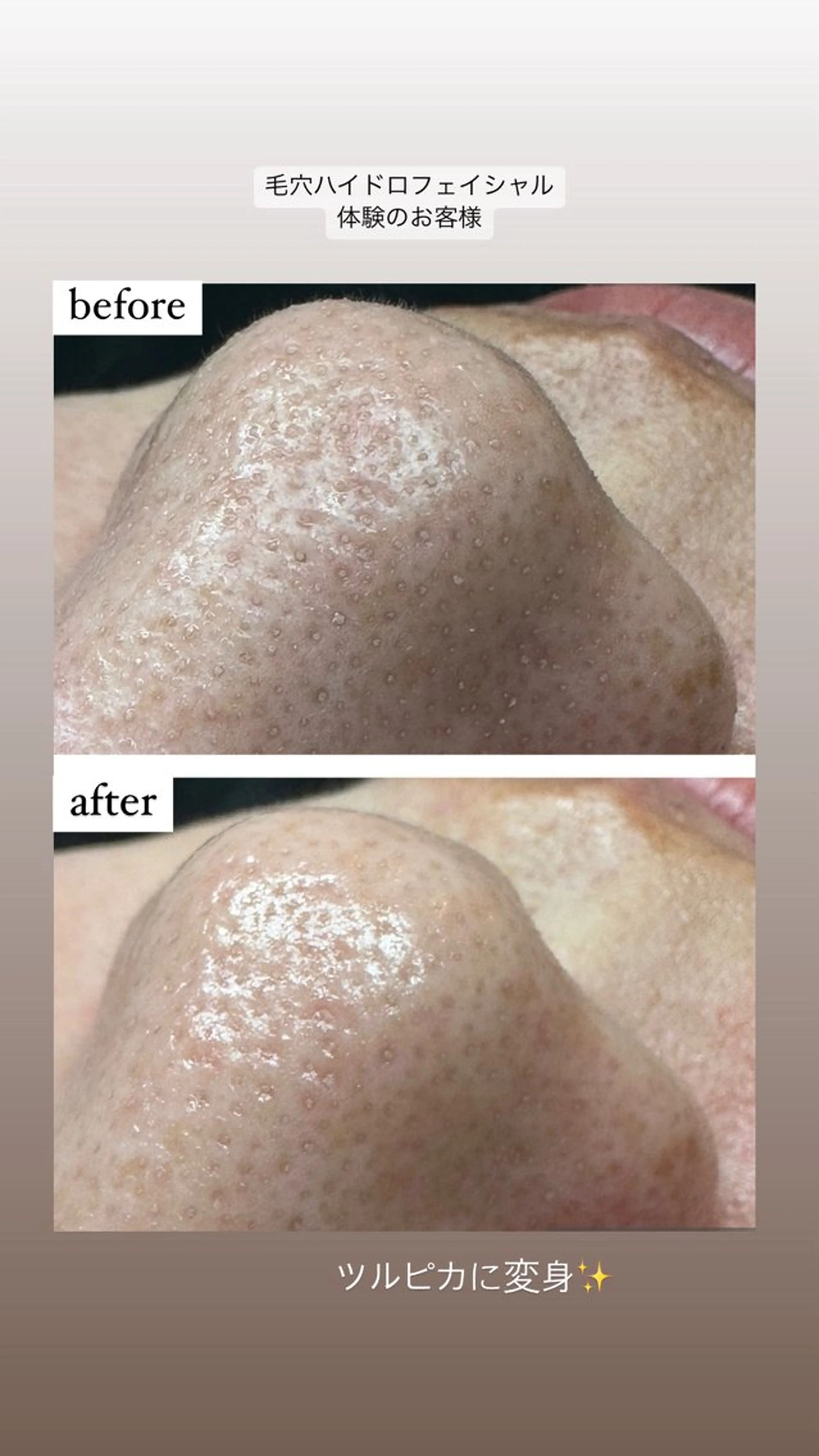 駒月 明日香のネイルデザイン