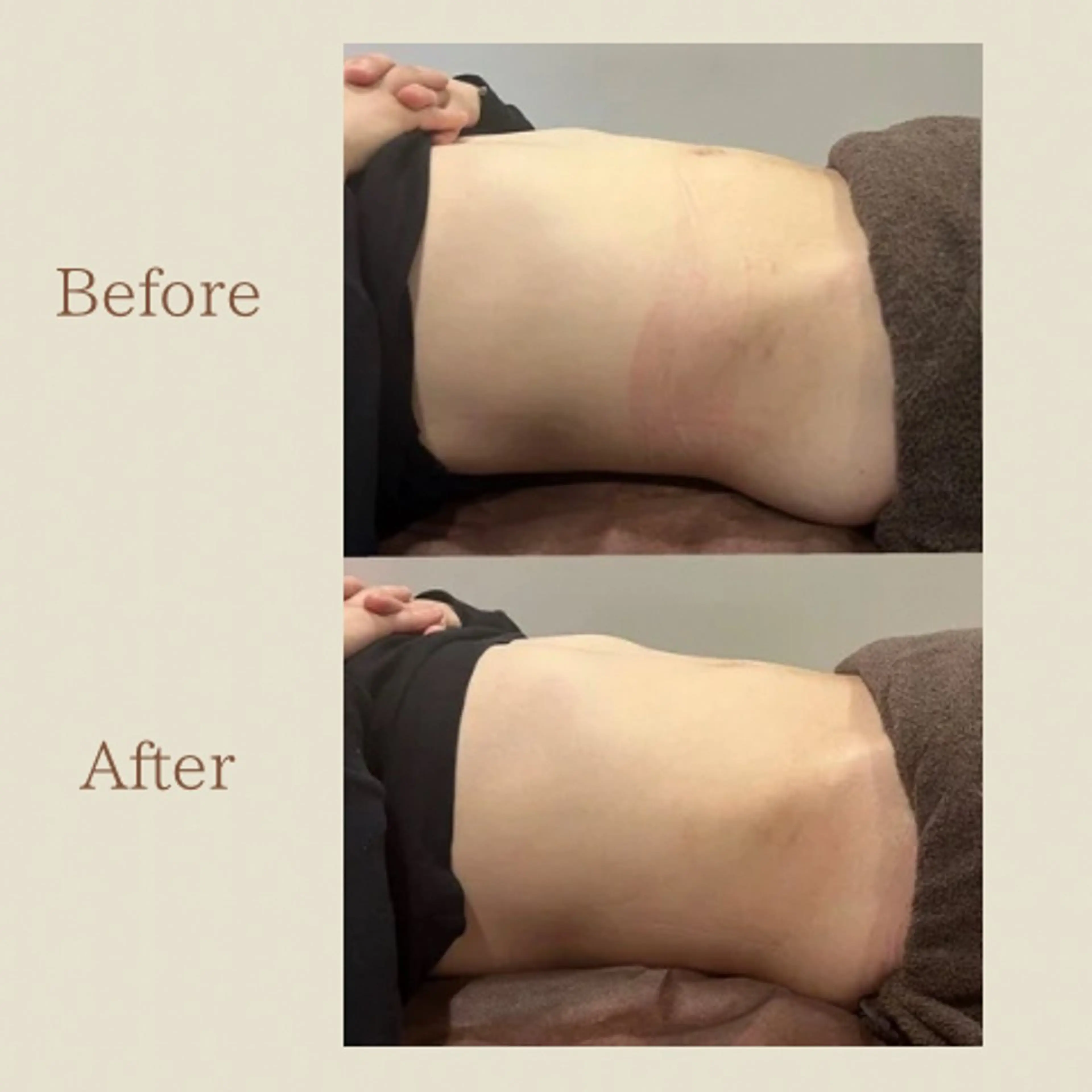 お腹痩せエステ Flat BELLY 恵比寿所属・【腸もみ/冷却痩身】 お腹エステ/恵比寿のエステ・リラクイメージ