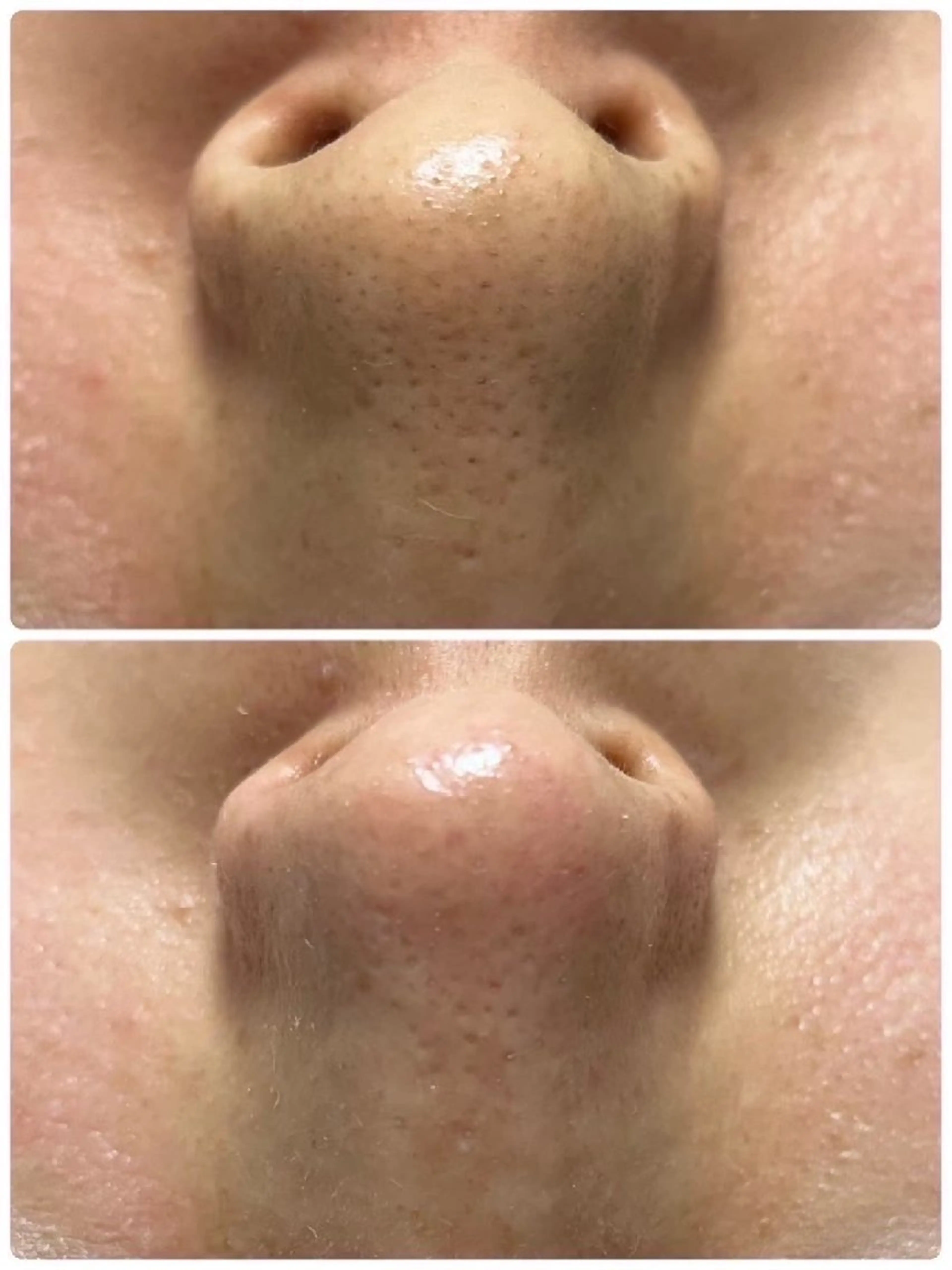 エステ TLIENGLE高宮 エステ・ネイルのエステ・リラクイメージ