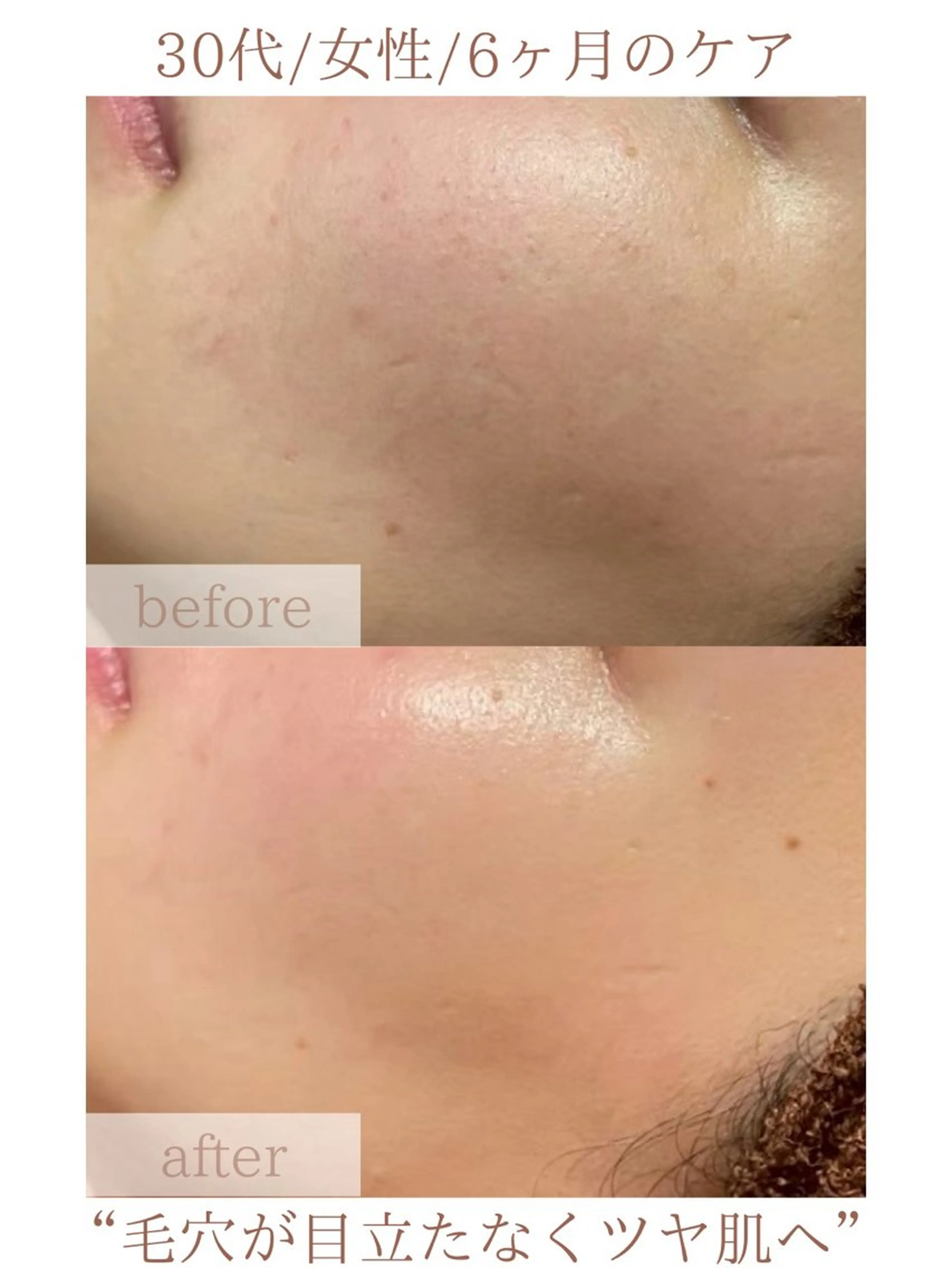 エステ ニキビ改善専門店 d'Albaのエステ・リラクイメージ