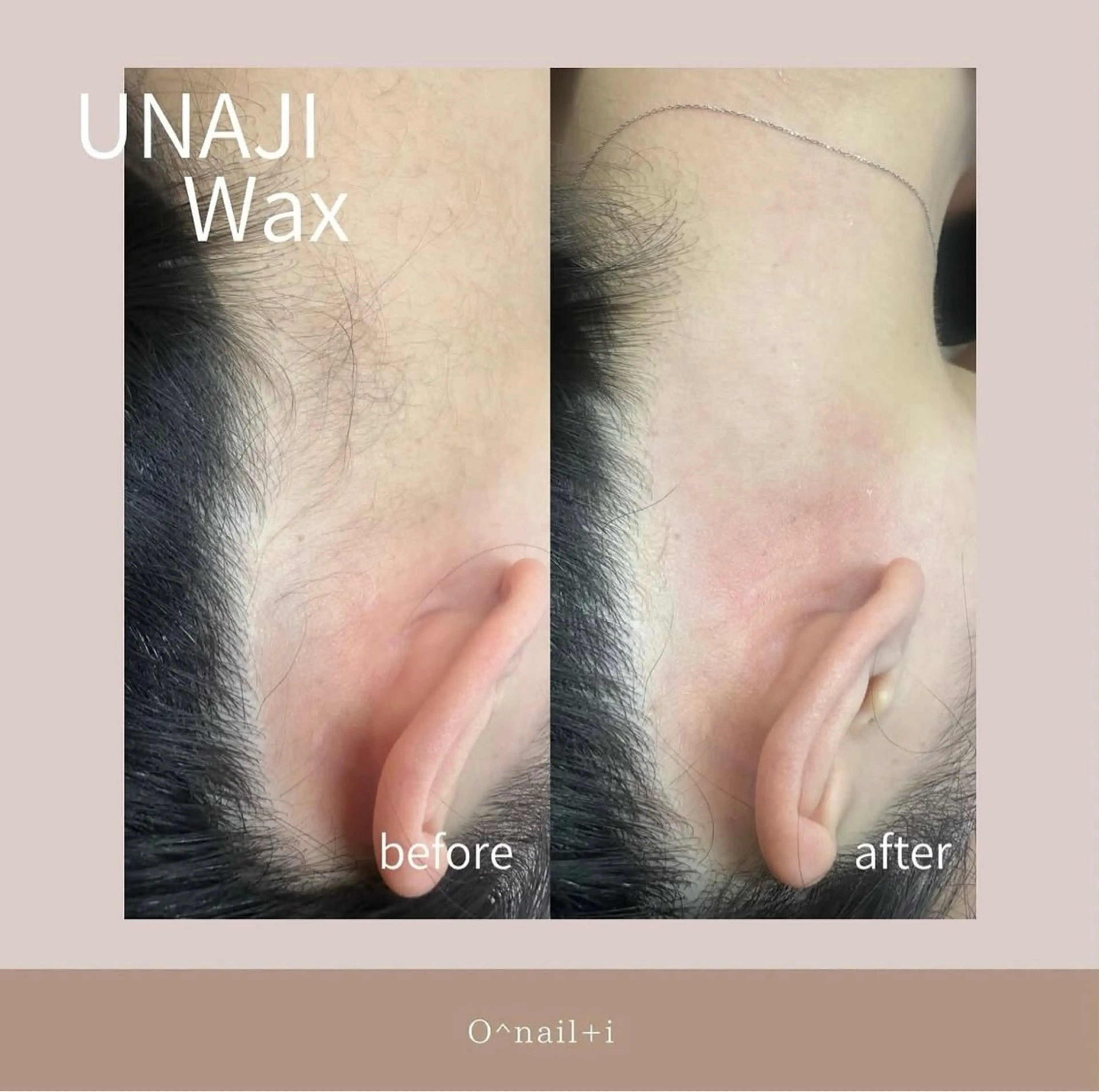 うなじWaxの写真