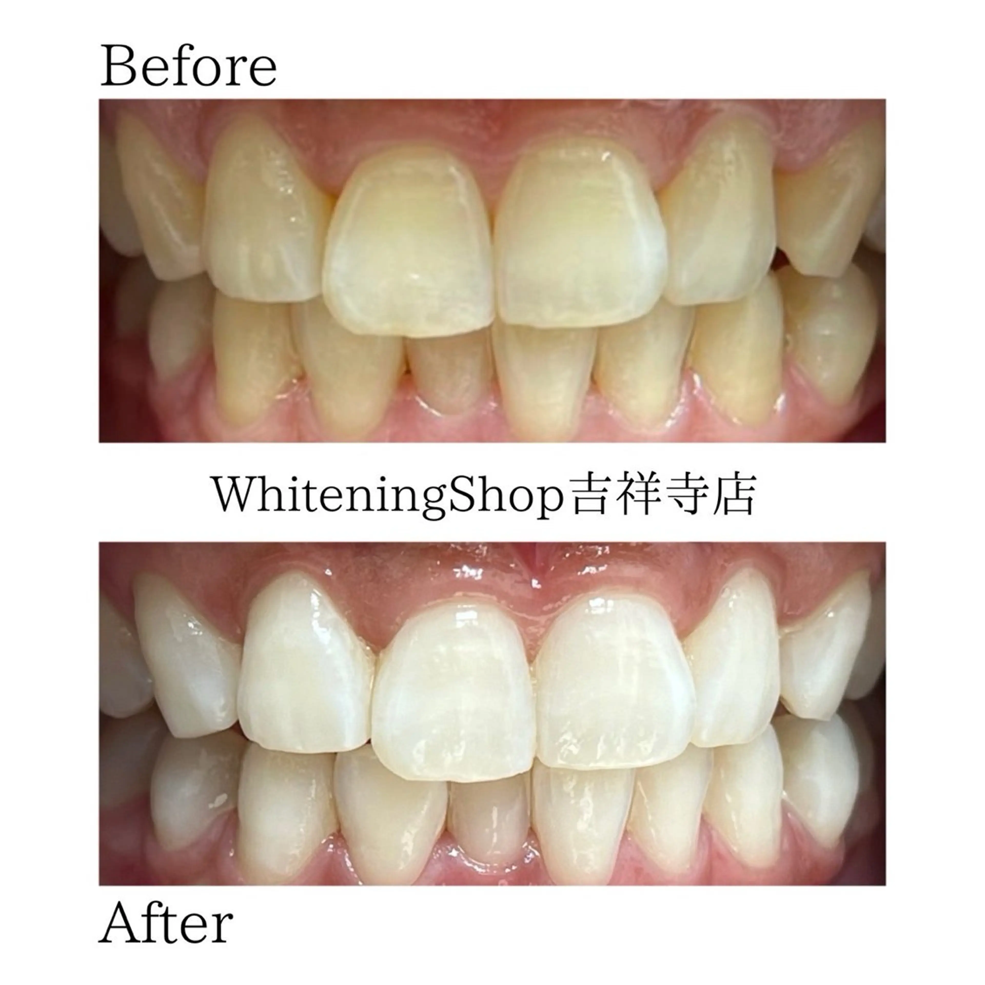 エステ リラク ホワイトニング ショップ吉祥寺店のエステ・リラクイメージ