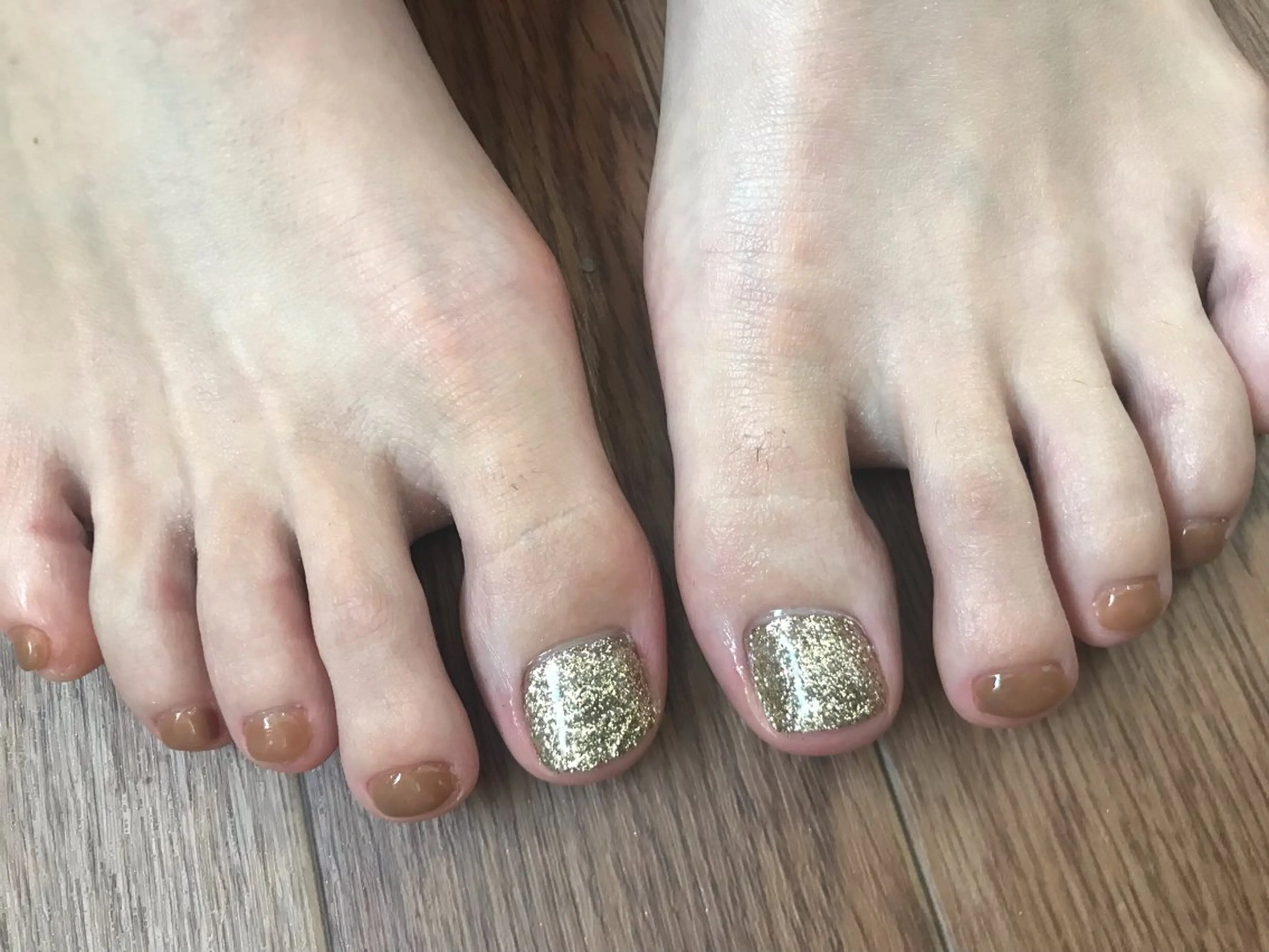 フットの季節到来！角質除去＋ワンカラーがセットです✨の写真