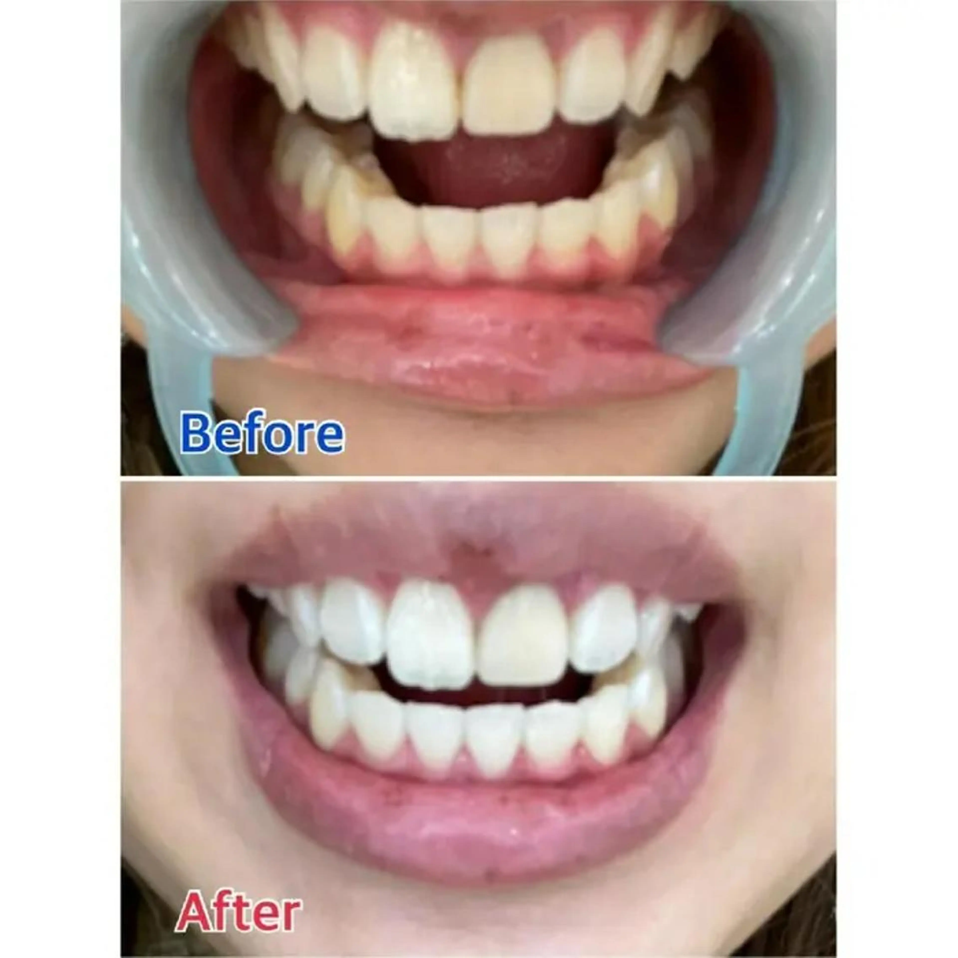 M渋谷店所属・M渋谷 ホワイトニングのエステ・リラクイメージ