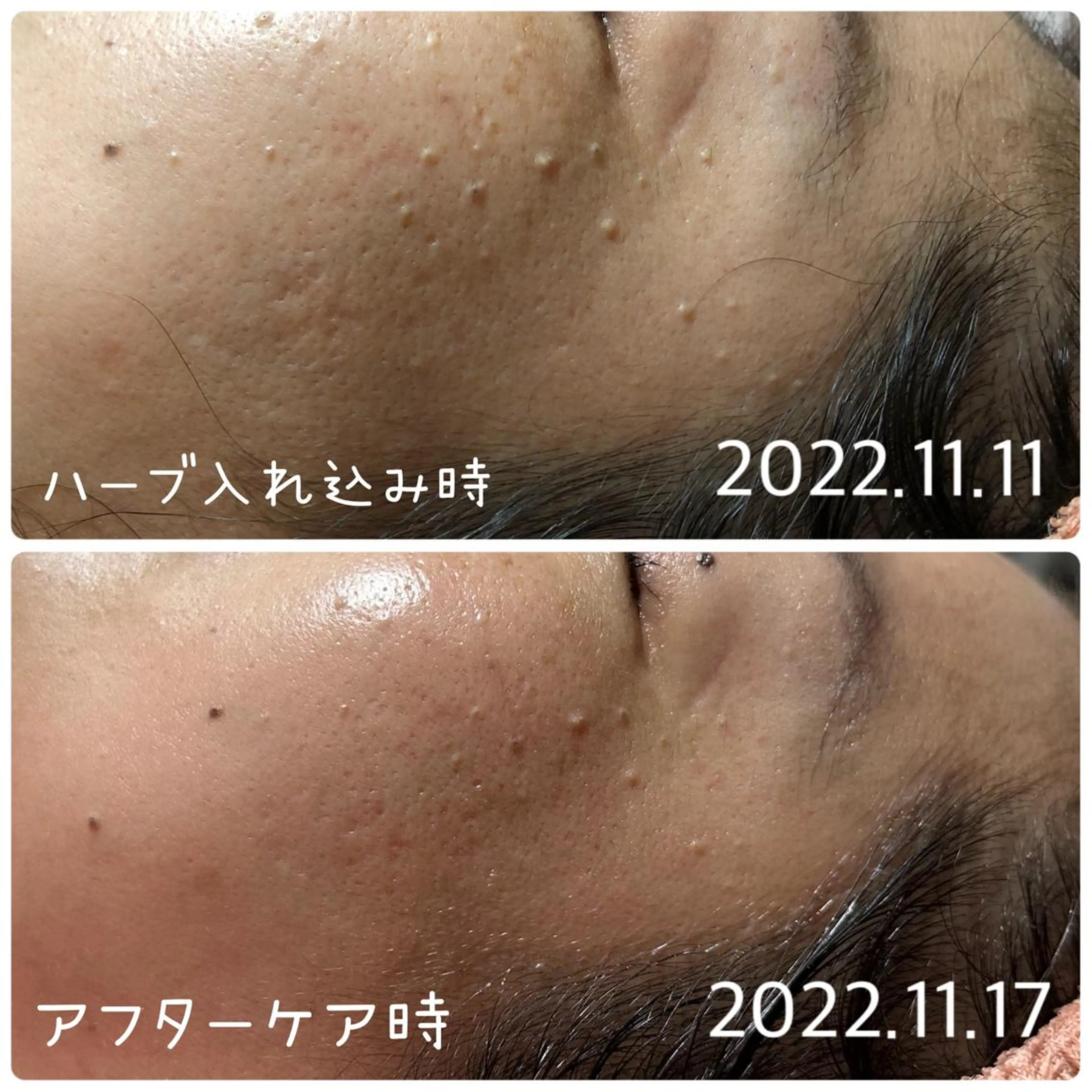 エステ デトックス専門サロン ココシュエットのエステ・リラクイメージ