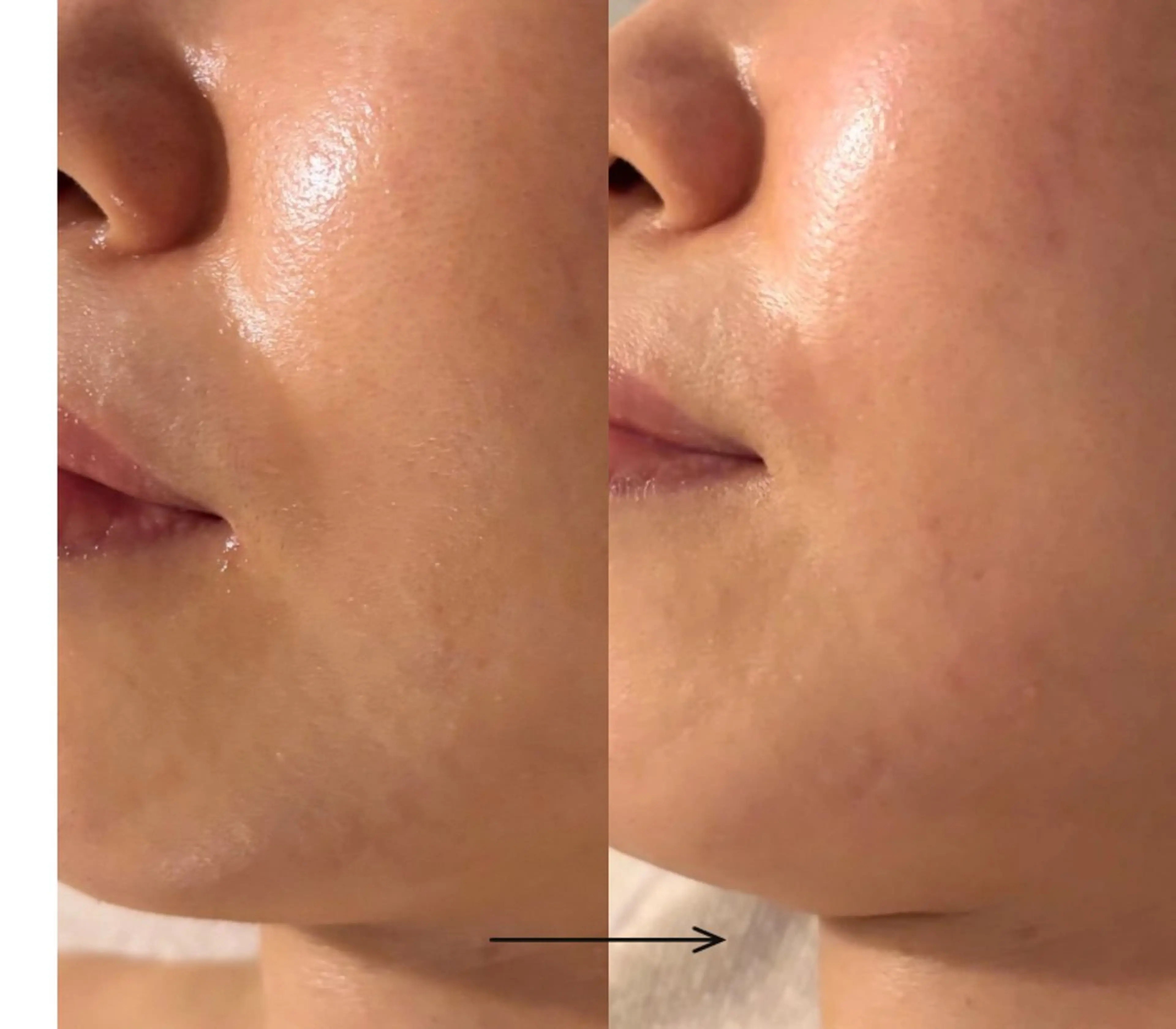 POLA THE BEAUTY 天王寺店所属・UEDA | POLA 天王寺のエステ・リラクイメージ